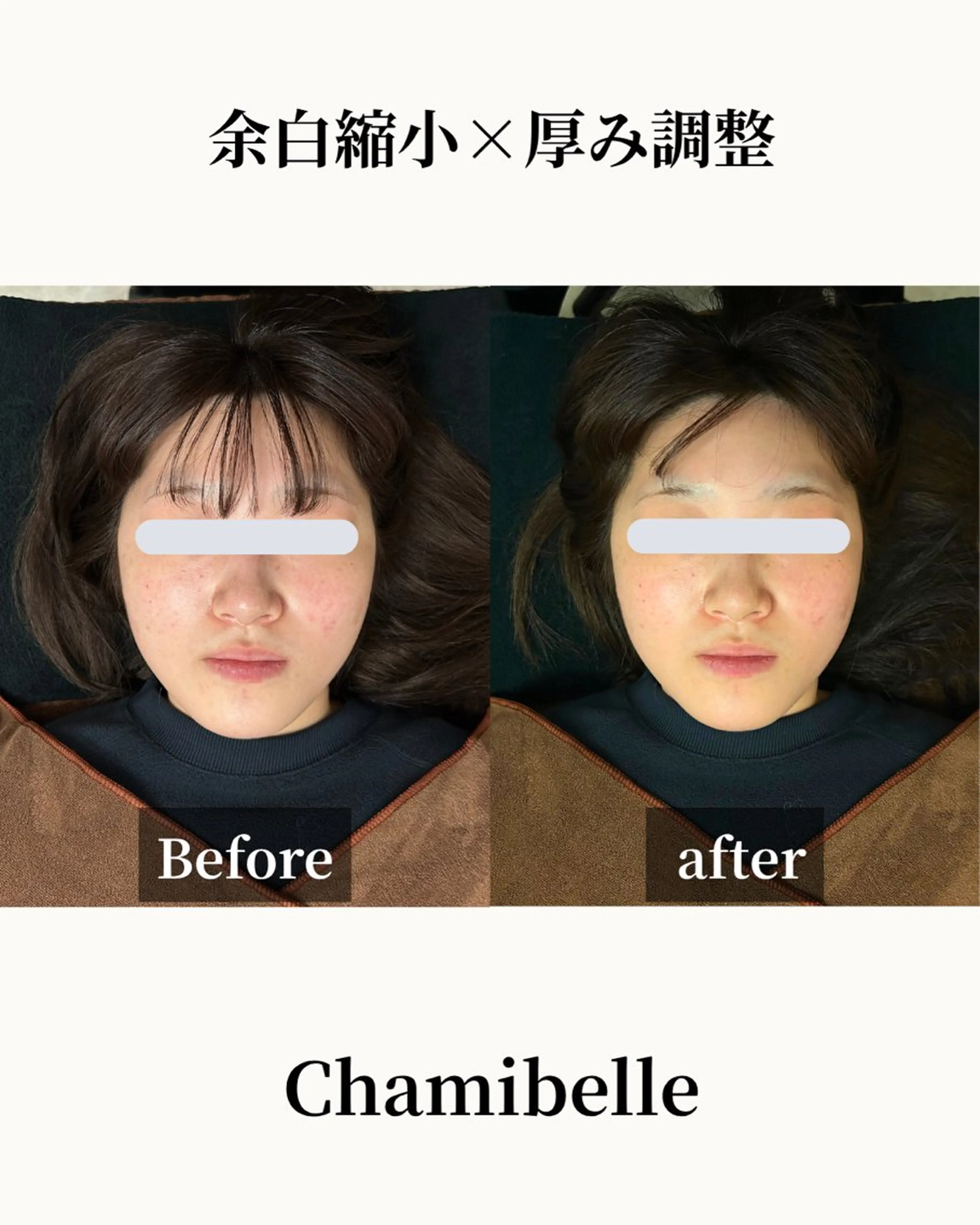 美容鍼灸サロン Chamibelleのエステ・リラクイメージ