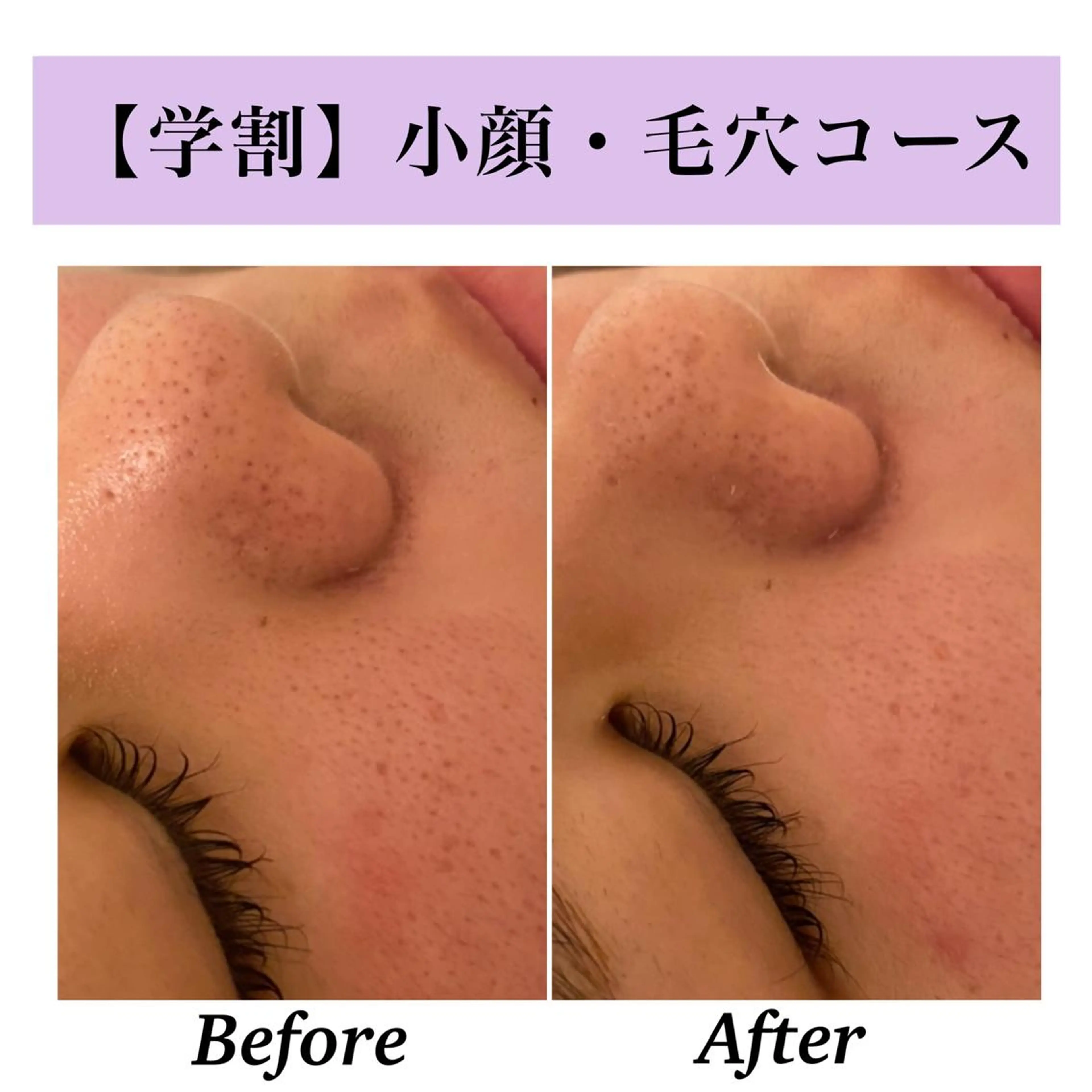 Bellesthe （ベルエステ）のエステ・リラクイメージ