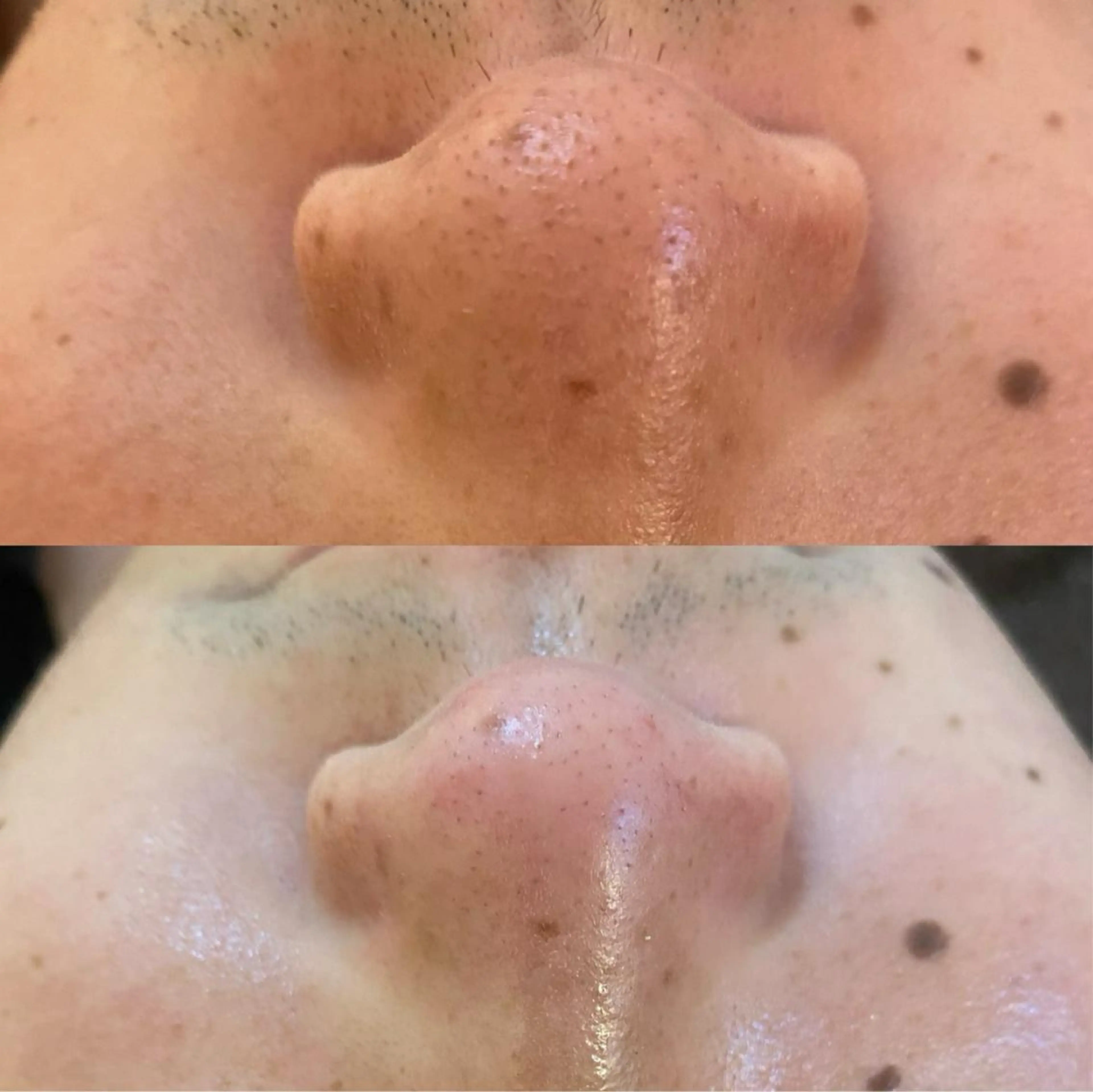 エステ リラク BELCIA福岡店　récolte de BELCIA（レコルトデベルシア）所属・BELCIA福岡店 レコルトデベルシアのエステ・リラクイメージ