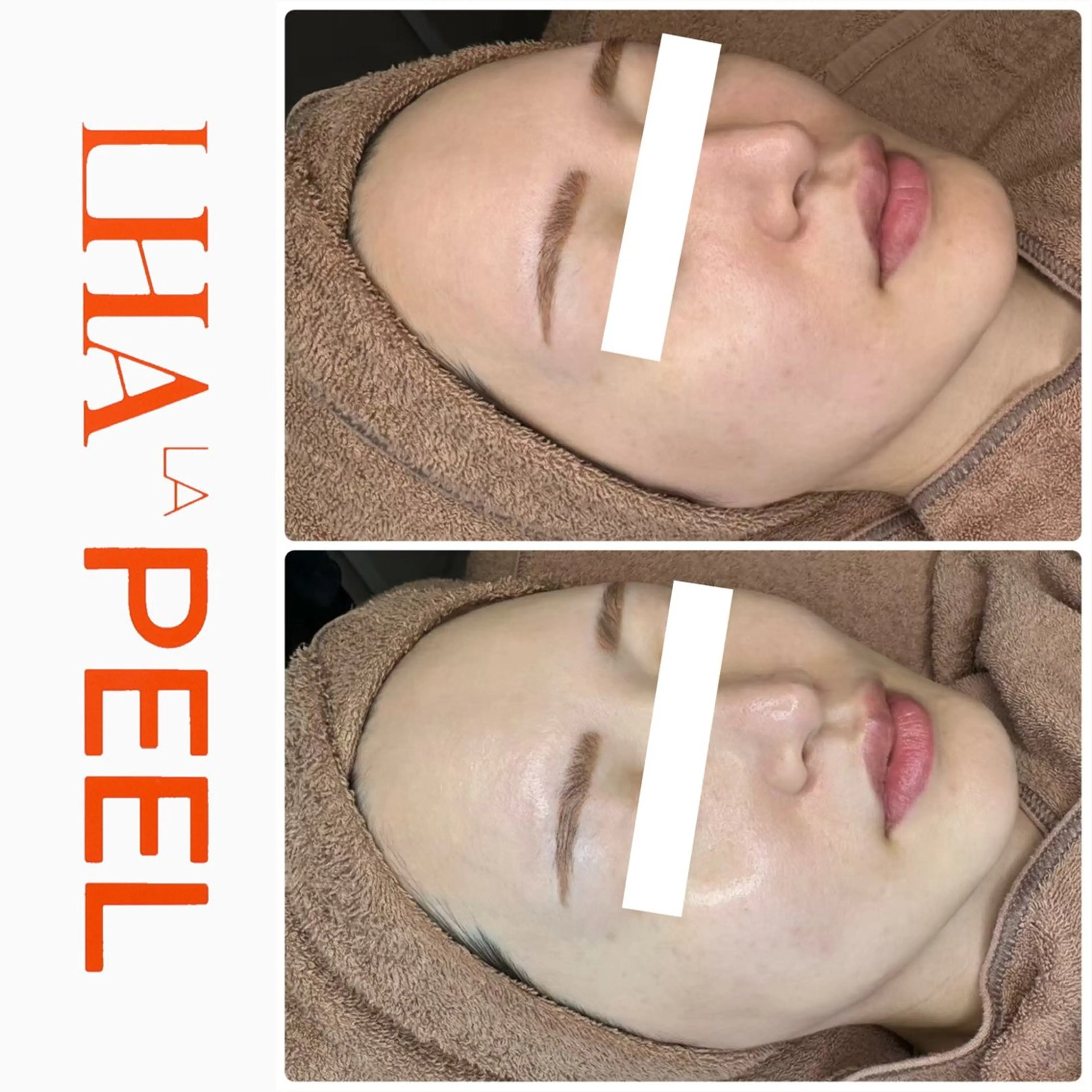 ハーブピーリング専門 BIOEL横浜のエステ・リラクイメージ