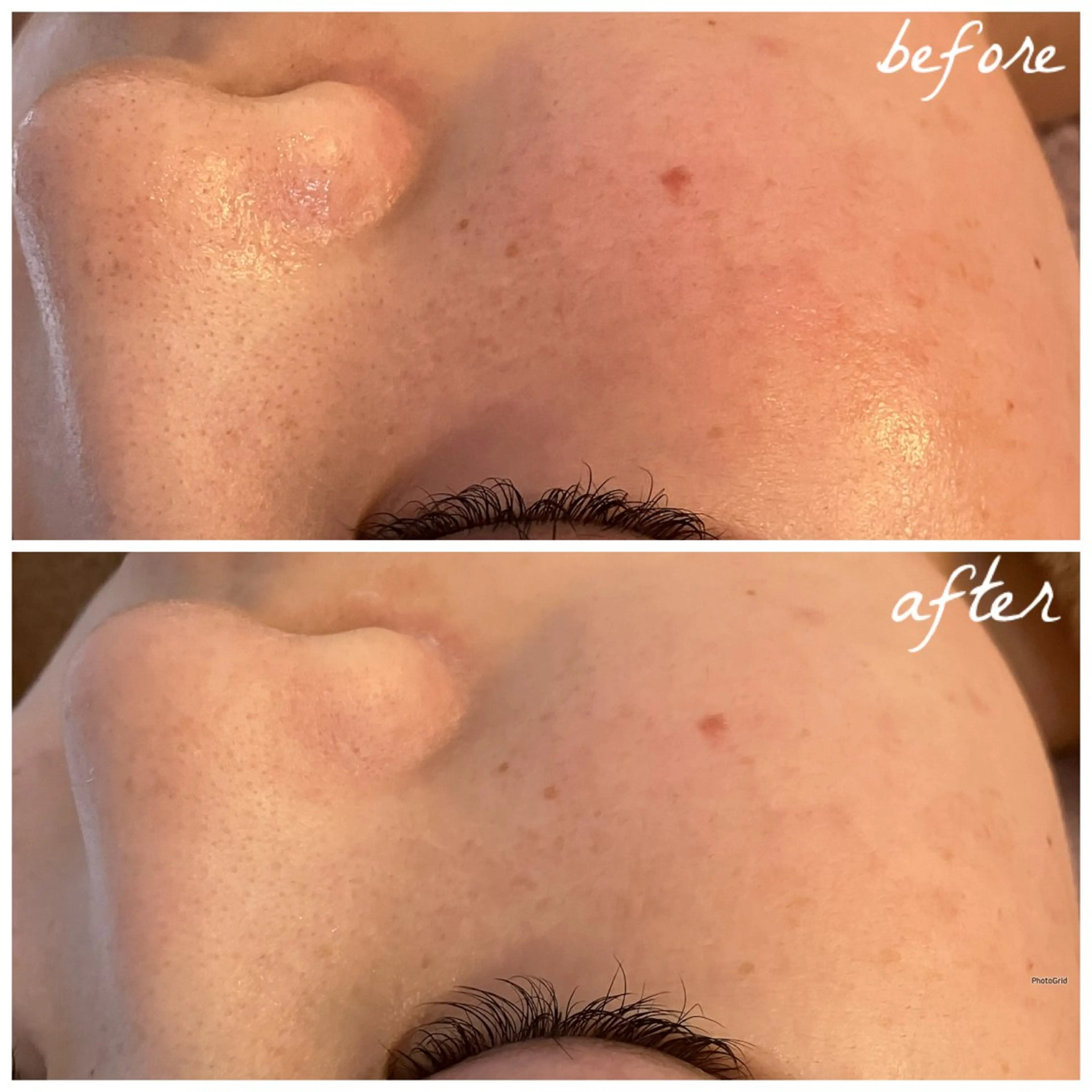 メンズ エステ メナード岐阜茜部 杉浦のエステ・リラクイメージ