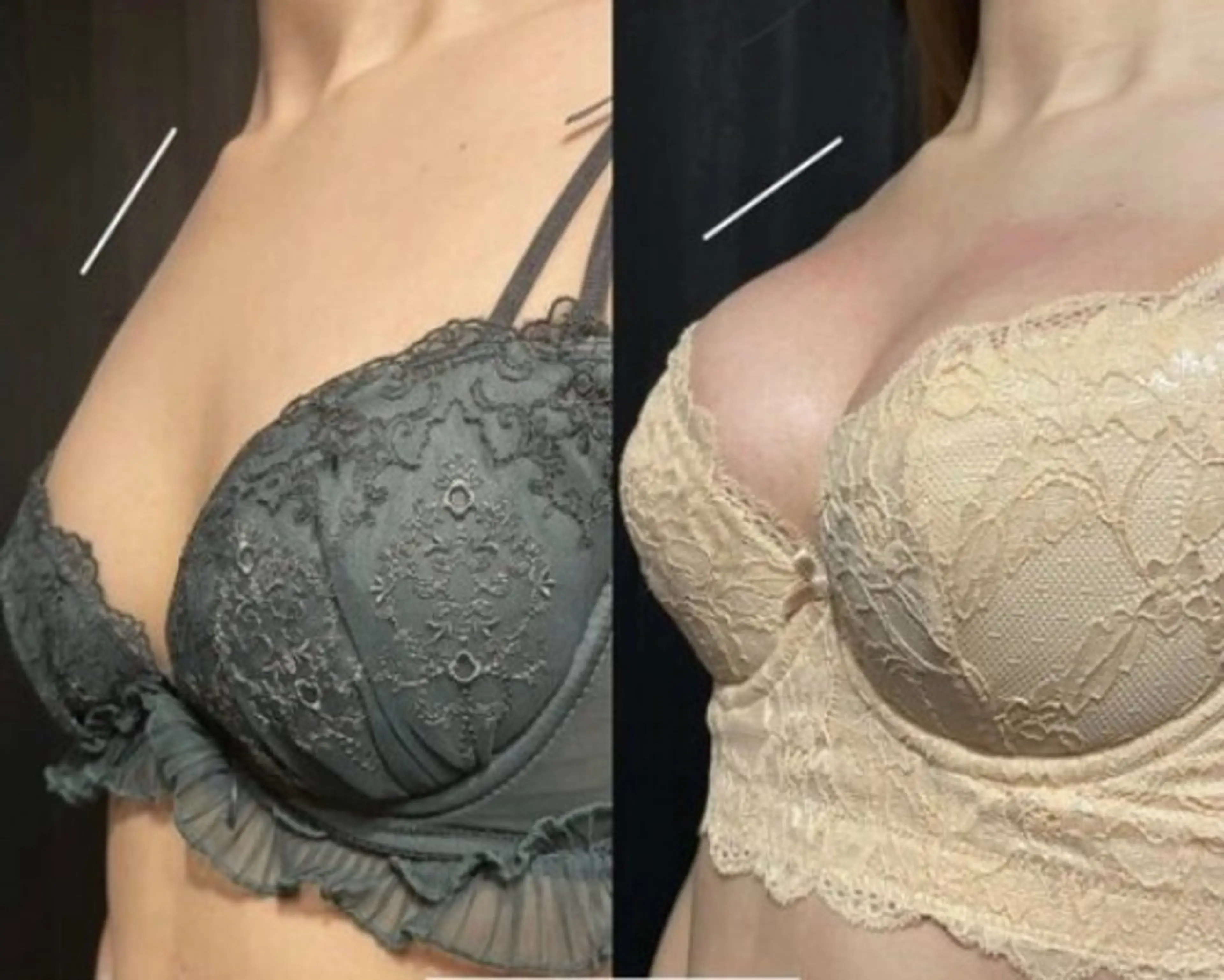 ミニモ学割U24以下初回限定　全身トリートメントの写真