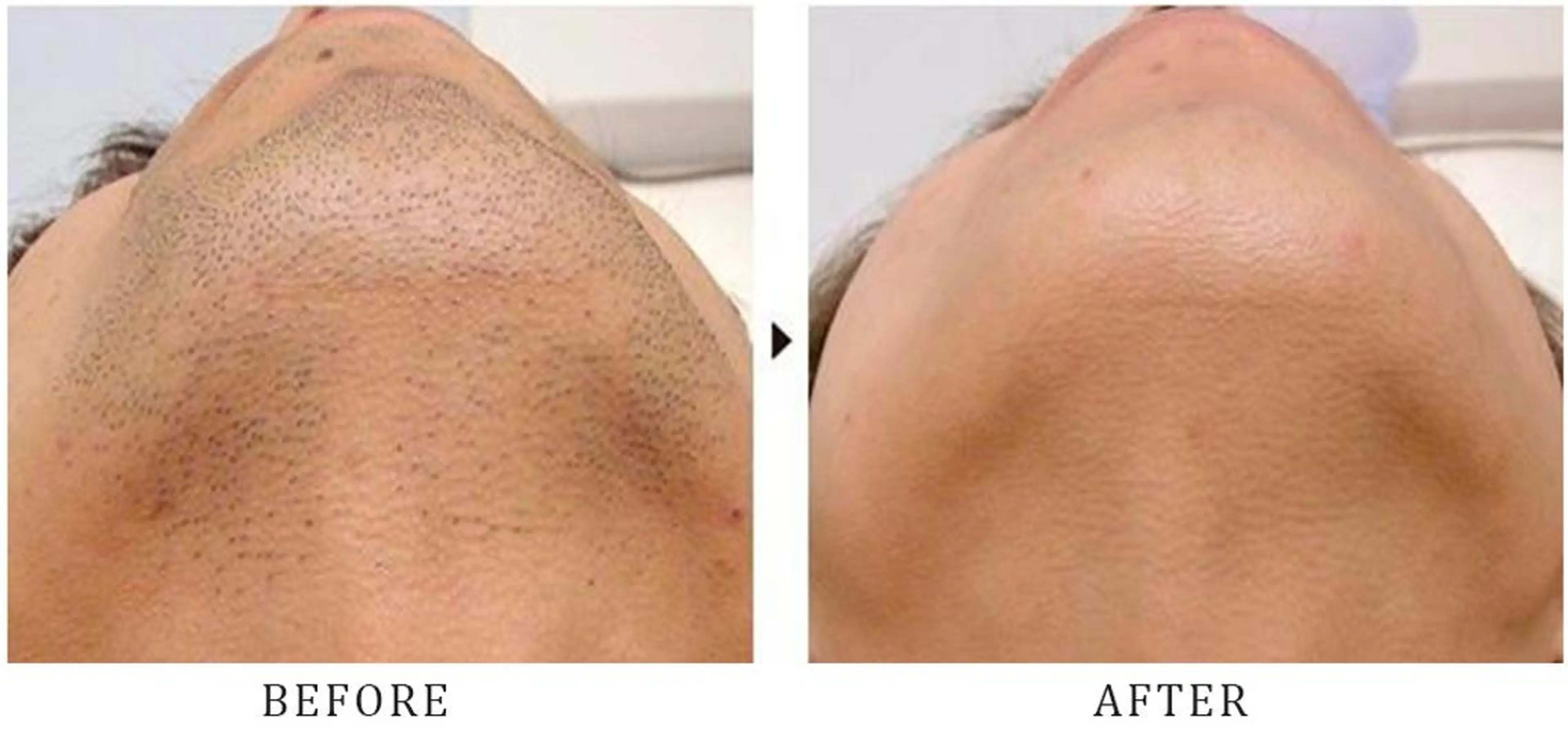 LANA所属・エステサロン LANA.のエステ・リラクイメージ