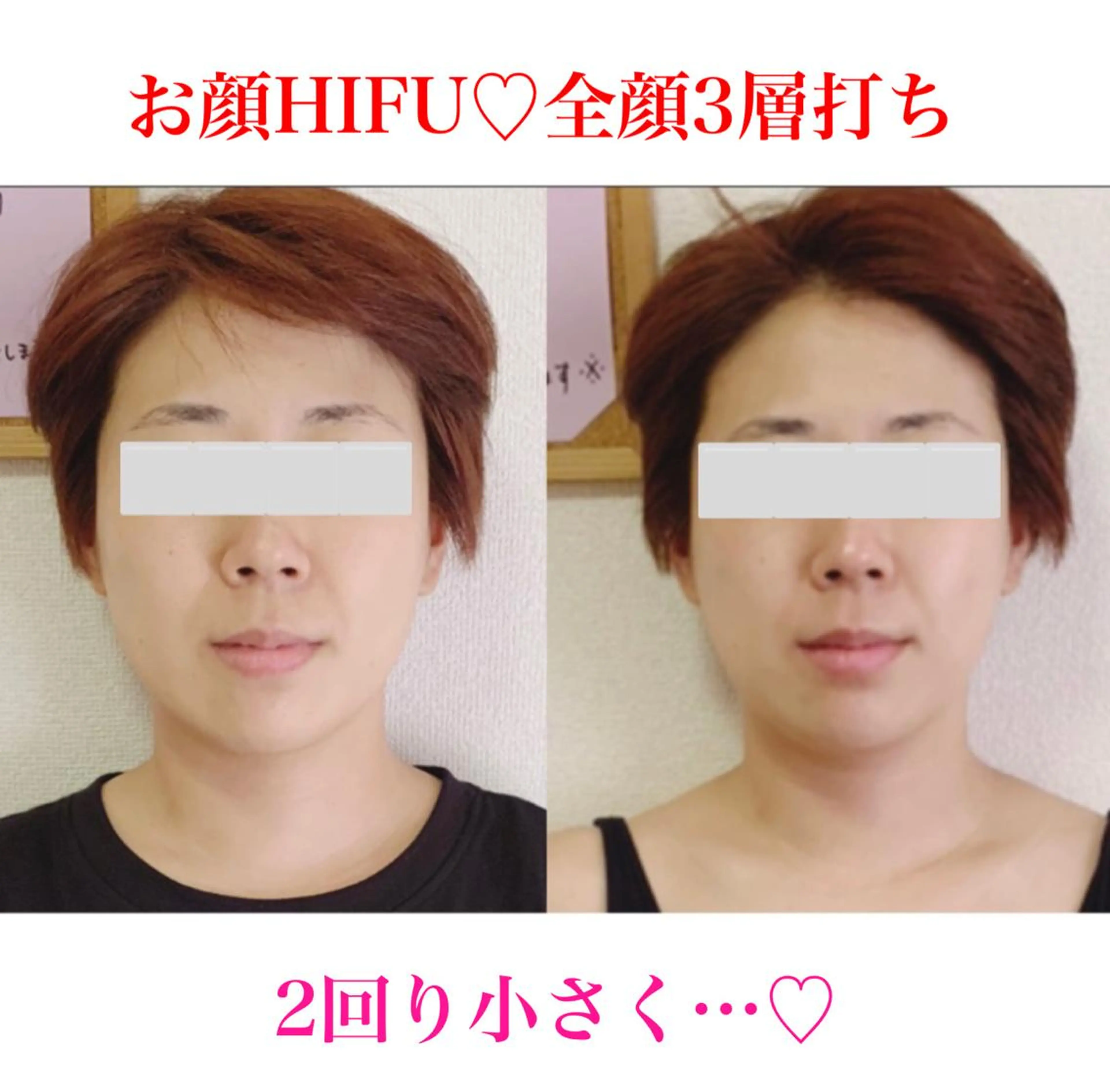 a  room salonのエステ・リラクイメージ