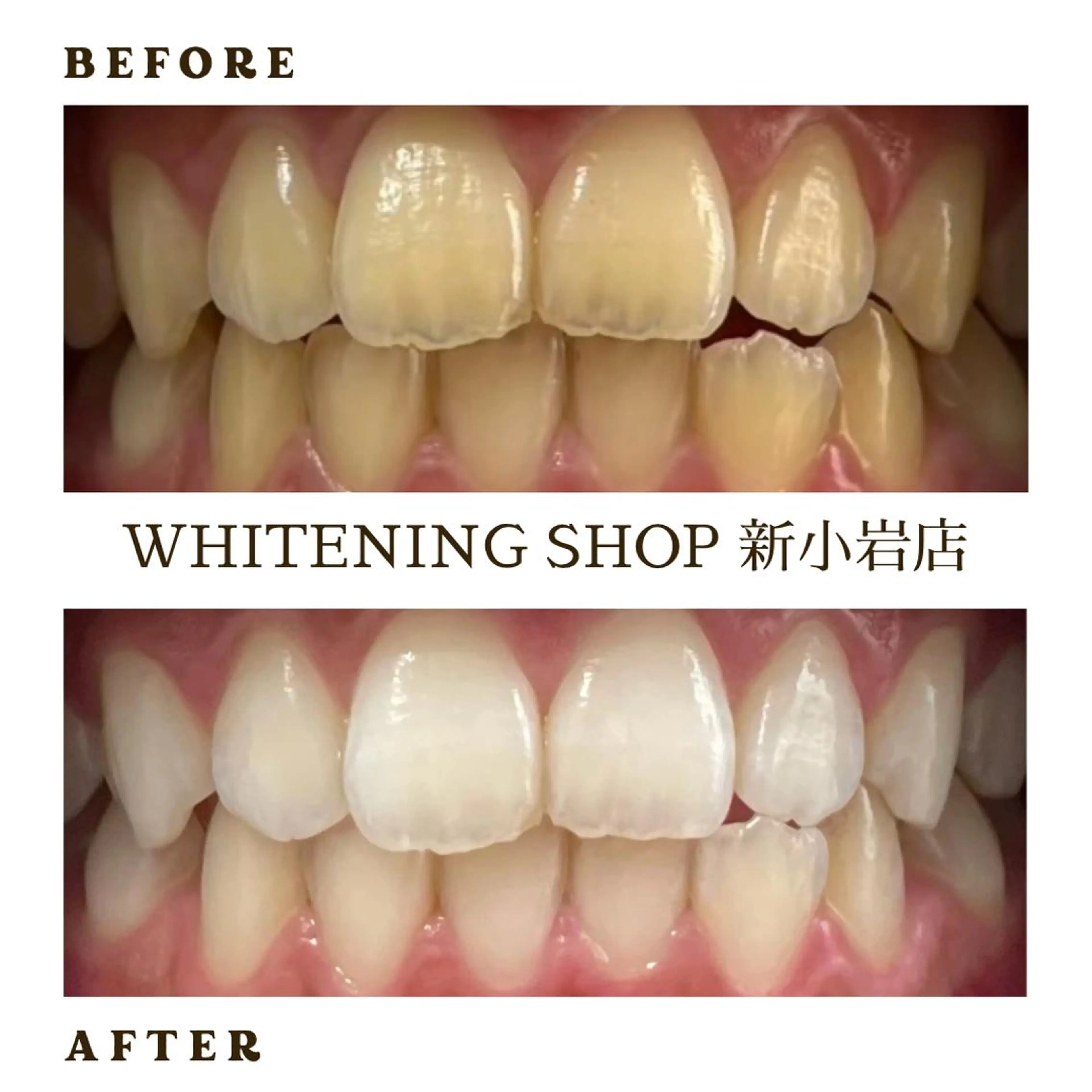 メンズ その他 ホワイトニング ショップ新小岩店のその他イメージ