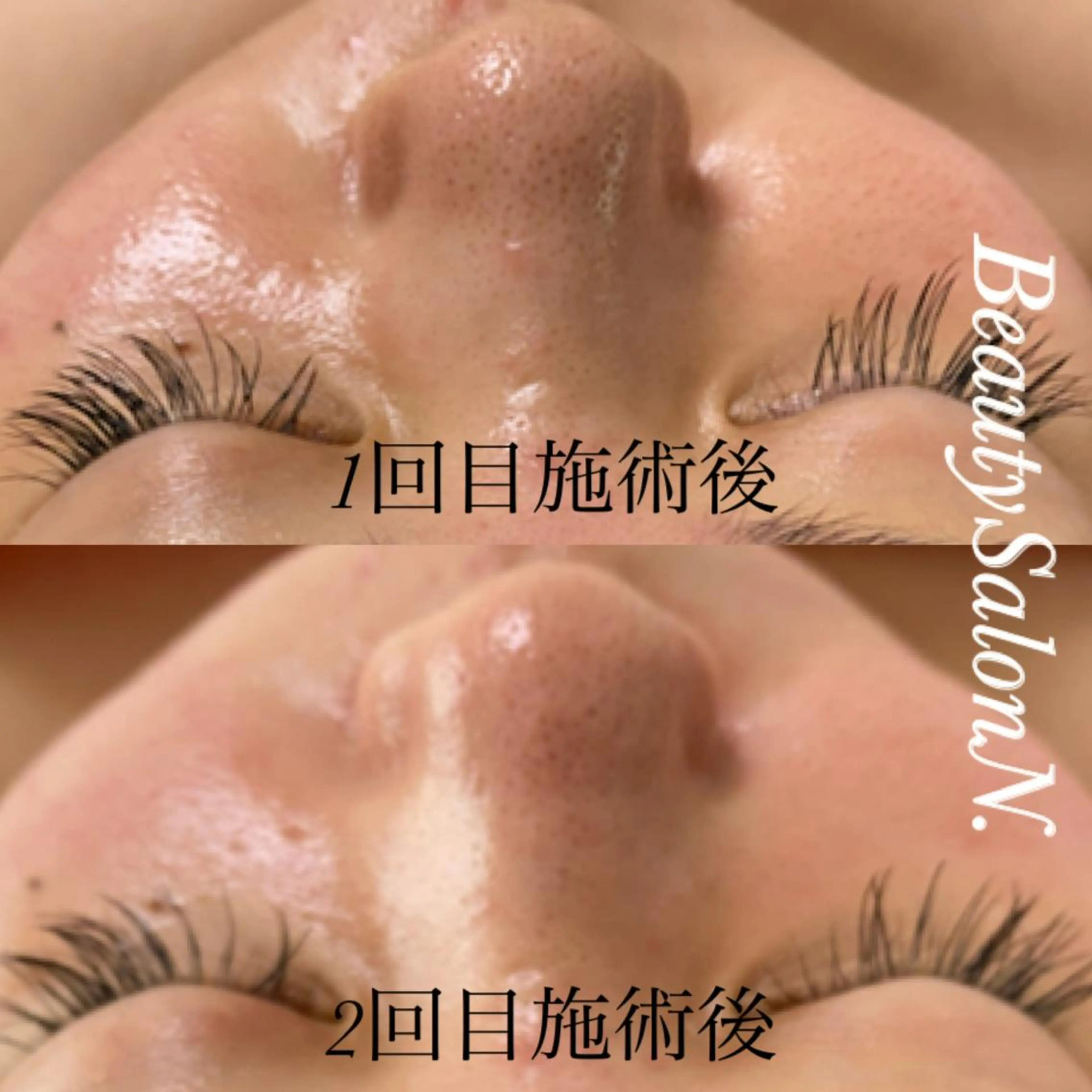 N. 鈴木翔子のエステ・リラクイメージ