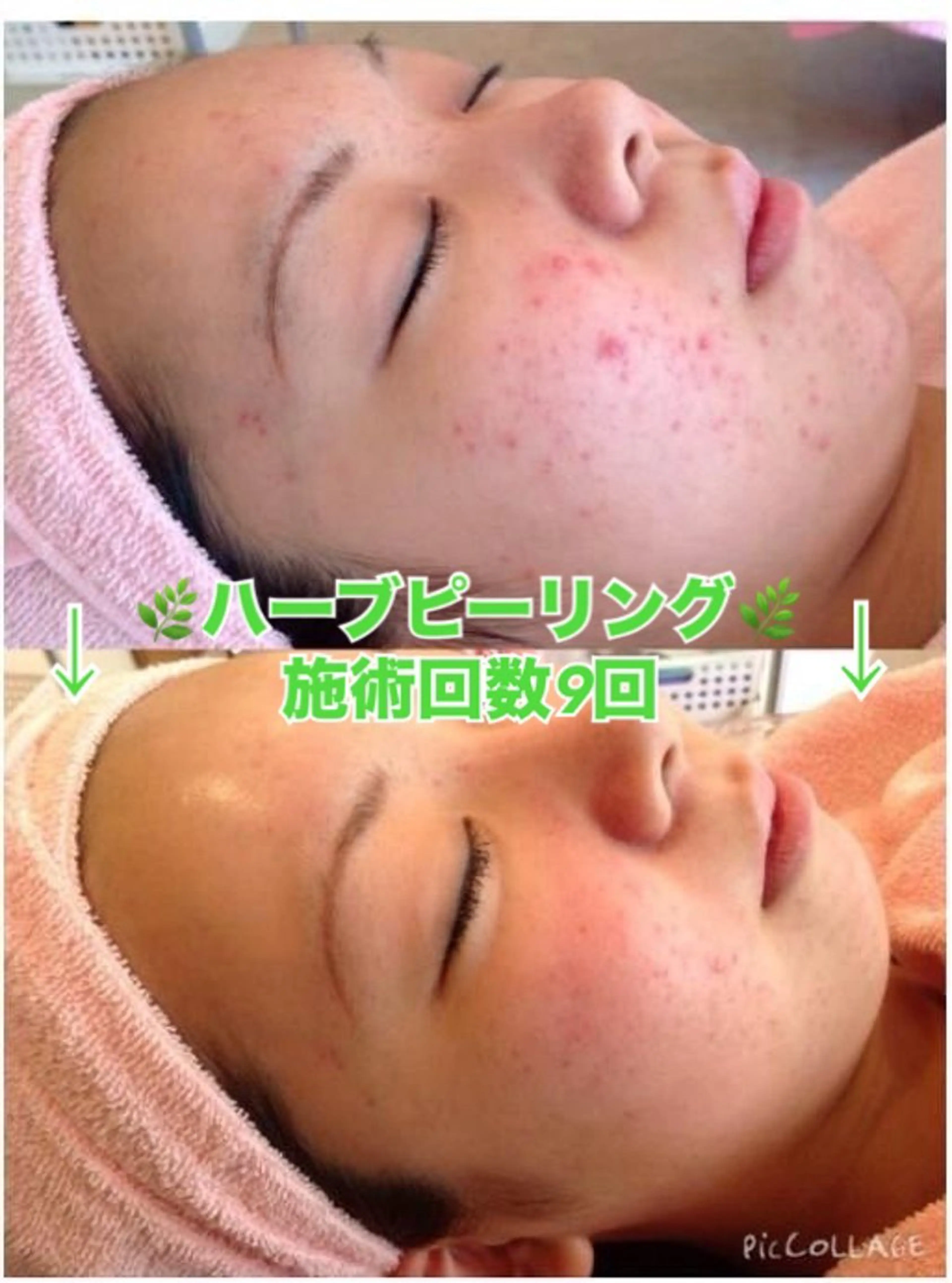 エステ 脱毛&美容サロン Dr.Epiのエステ・リラクイメージ