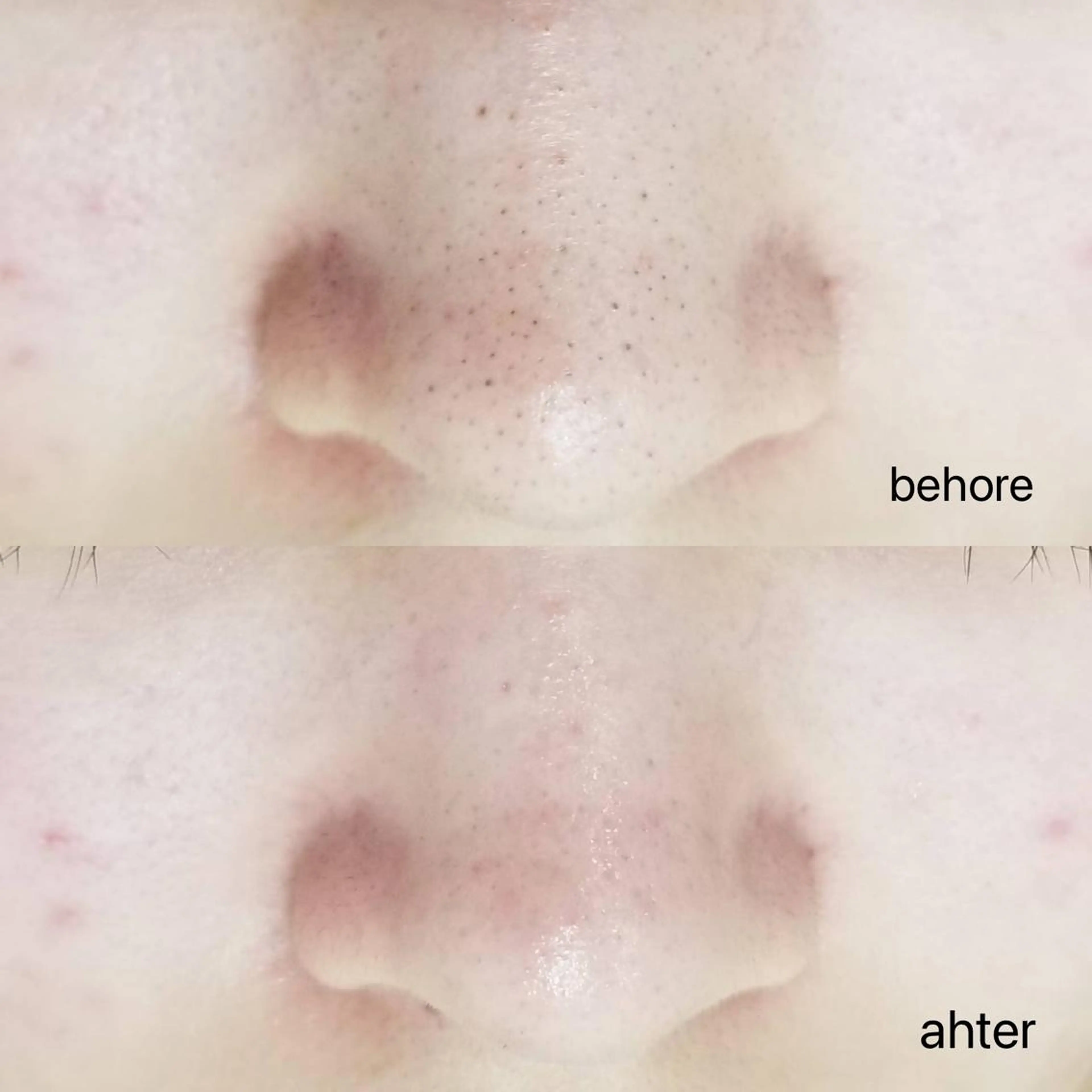 エステ Anacia Beauty Salon所属・美肌脱毛&毛穴専門 Anaciaのエステ・リラクイメージ