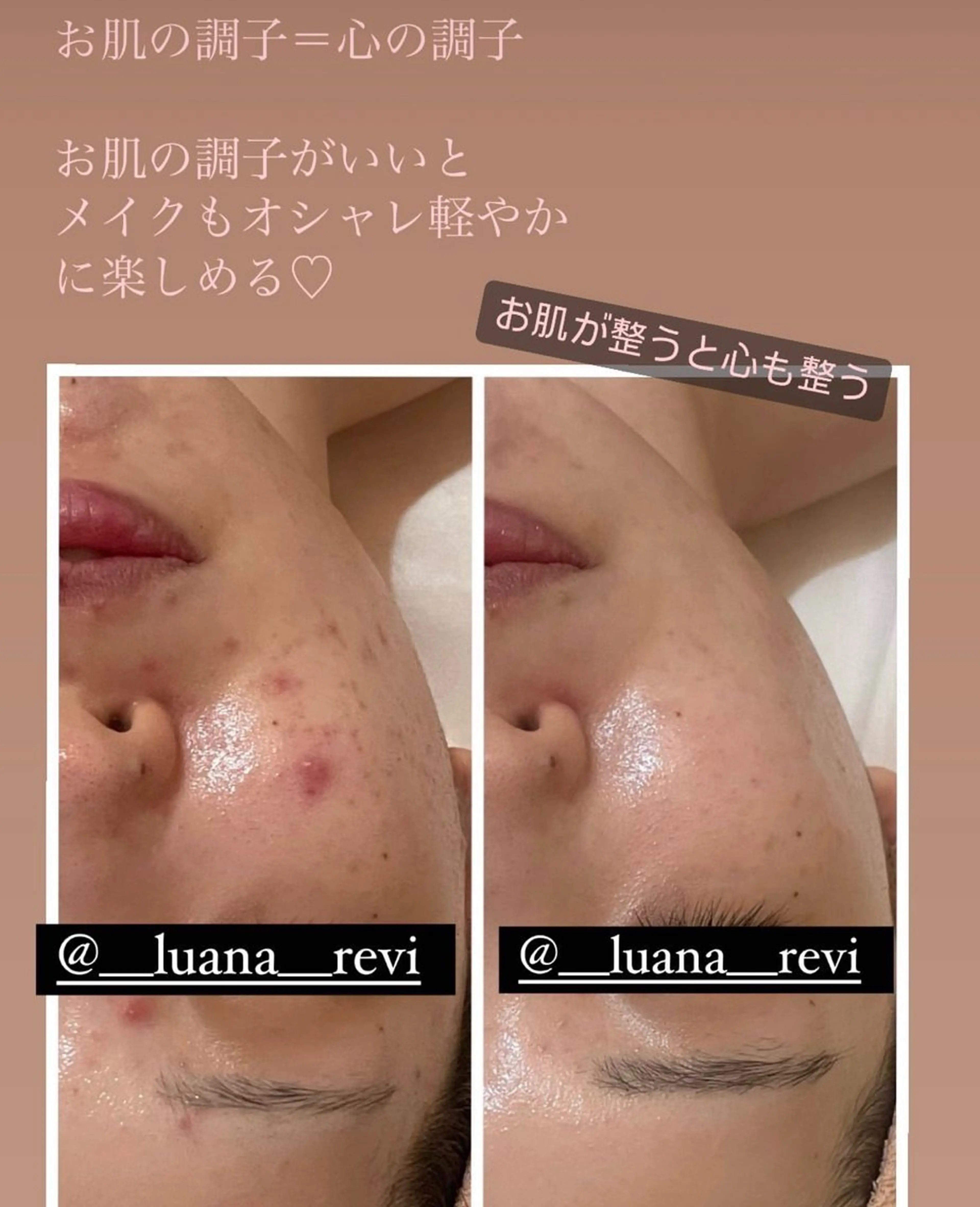 Luana ∞のエステ・リラクイメージ