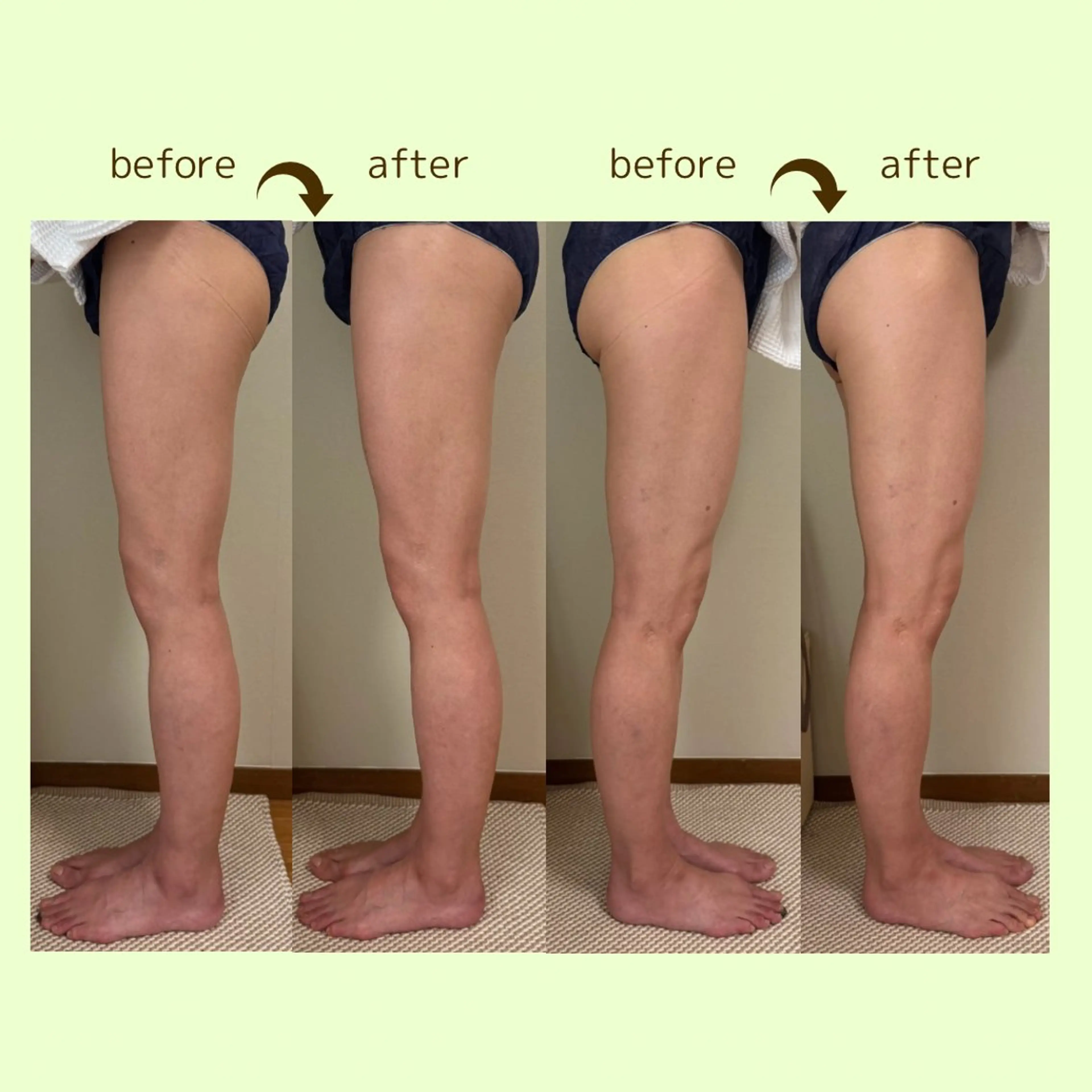 リラクゼーションスパ　ひのき所属・spaHINOKI 【女性専用】のエステ・リラクイメージ