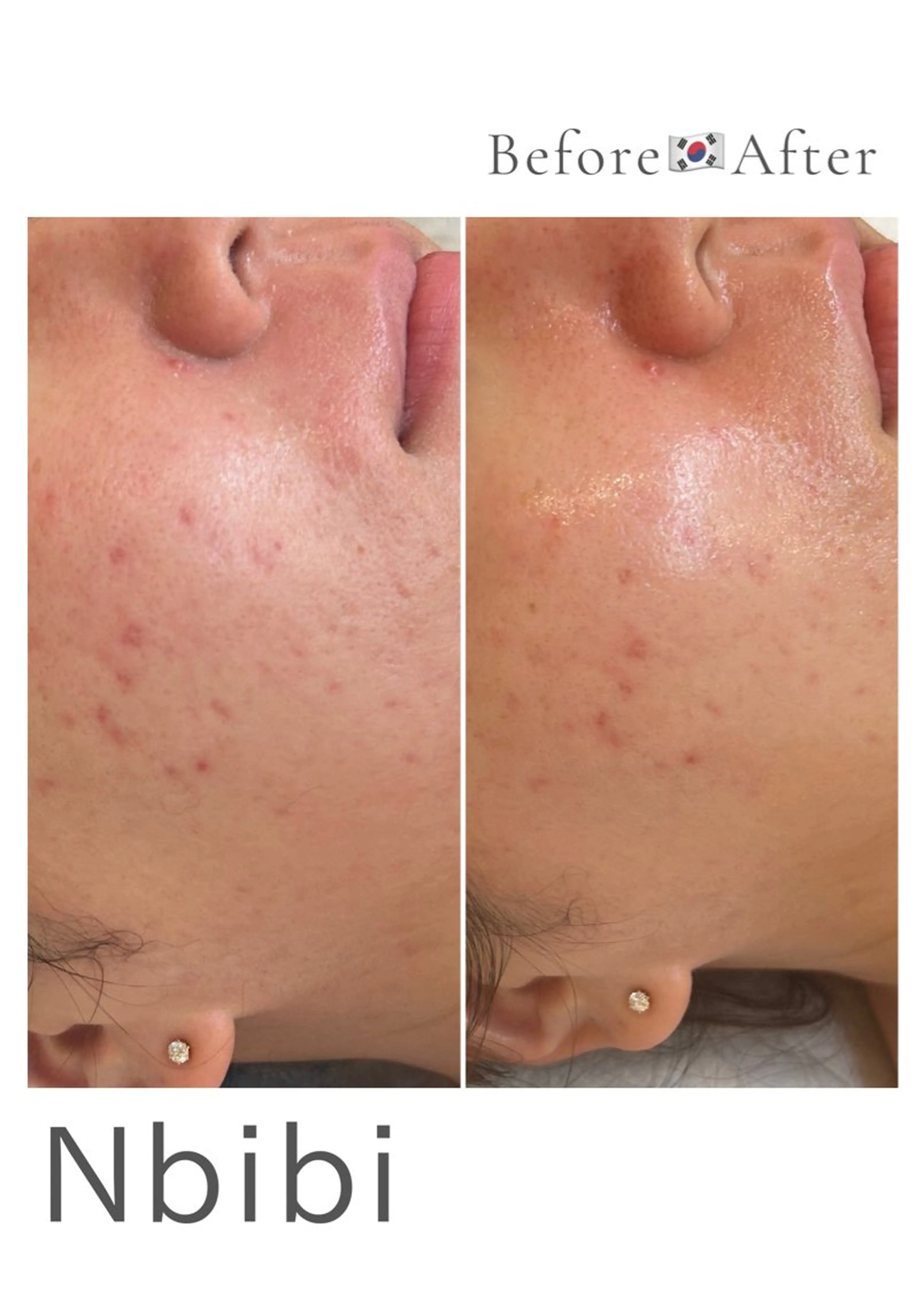 韓国🇰🇷価格 サロン_Nbibiのエステ・リラクイメージ