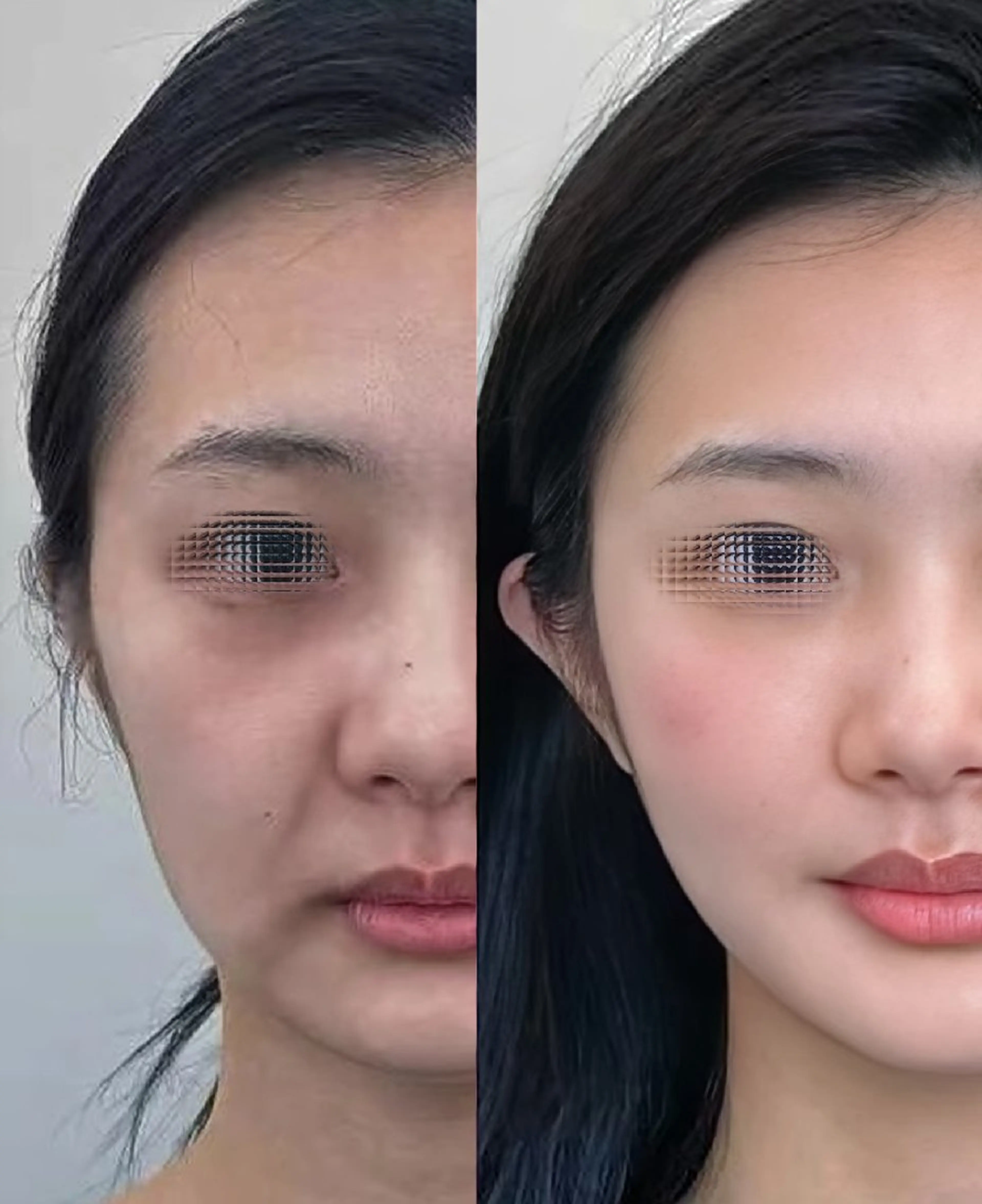 マツエク・マツパ 結婚式・ブライダル aliaハイフ&水光ジェットサロン所属・aliaハーブ水光店 エステティシャン募集のエステ・リラクイメージ