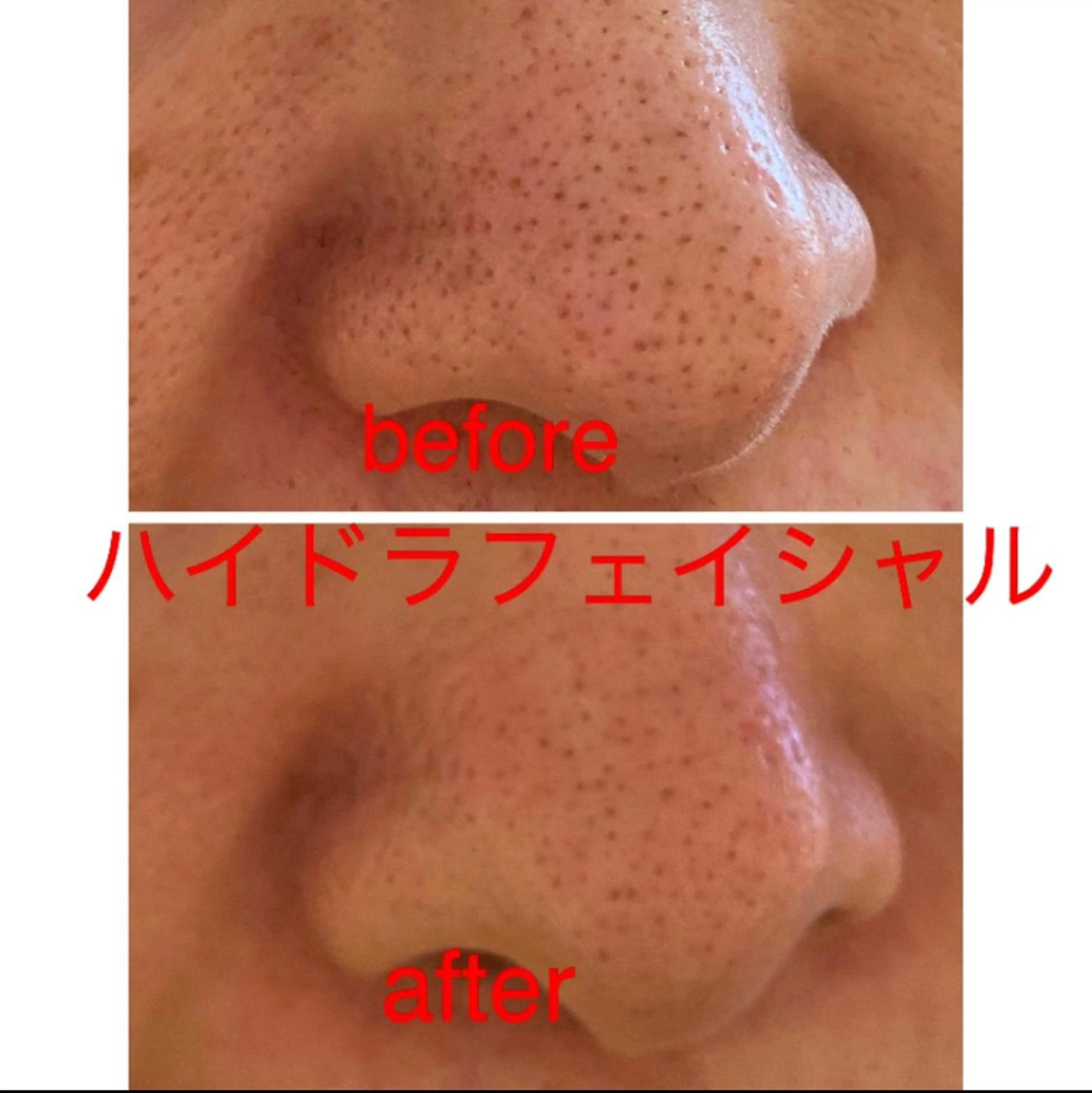 エステ プリート毛穴洗浄美肌 Pulitoのエステ・リラクイメージ