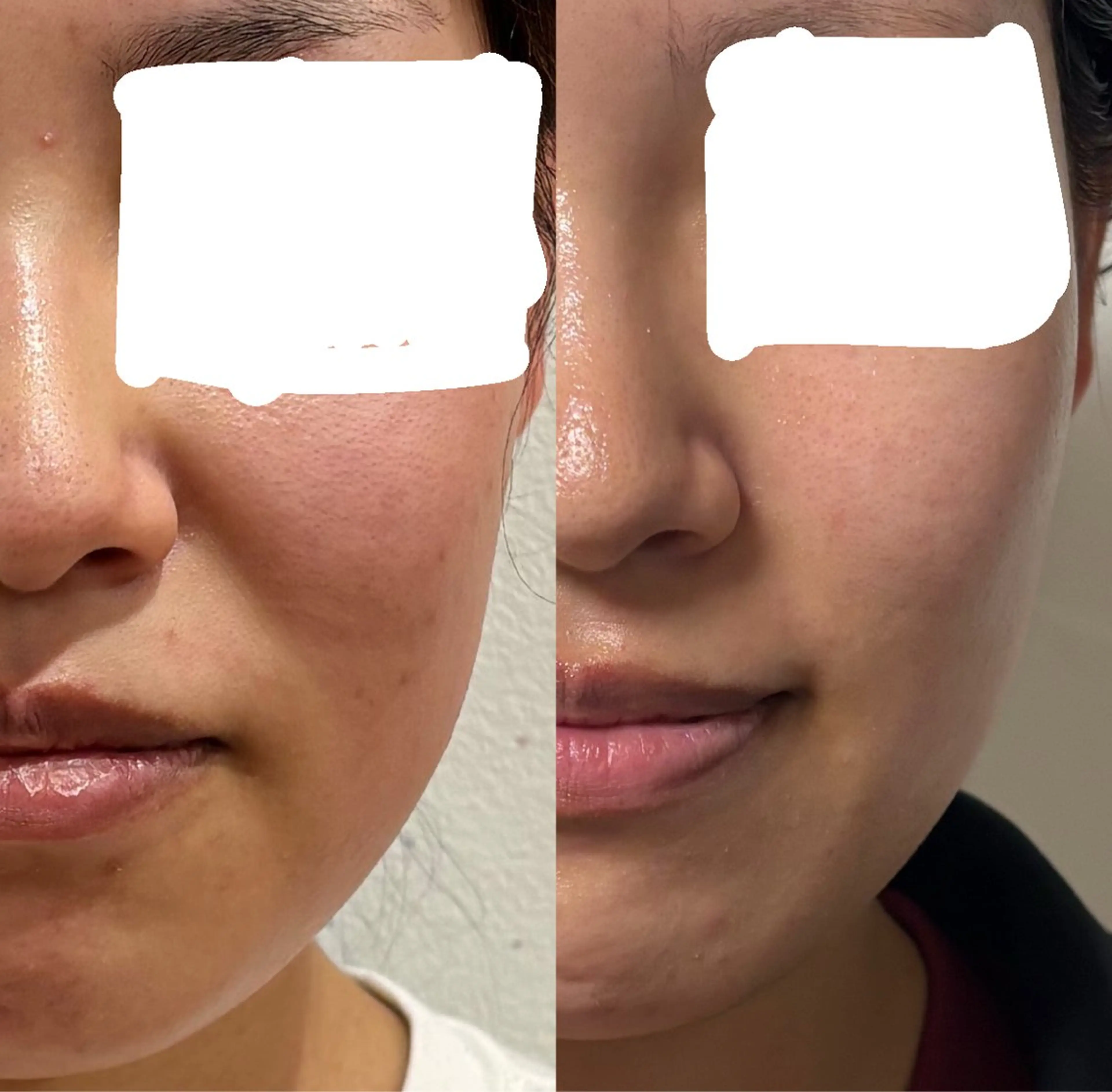 sakura room久我石原のエステ・リラクイメージ