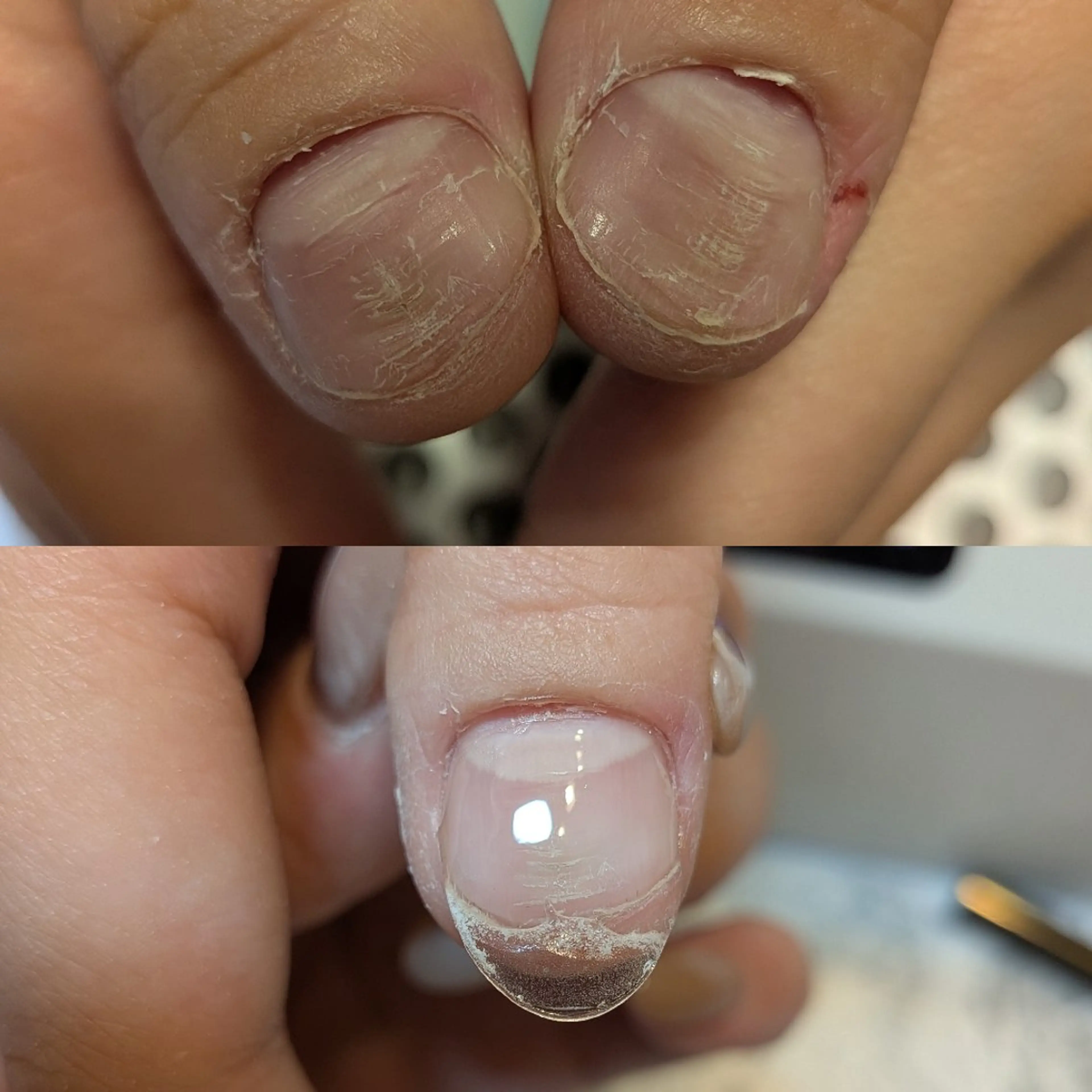 ネイル ハンドネイル ハンドケア ネイリストゆか💅 長さだし、深爪矯正のネイルデザイン