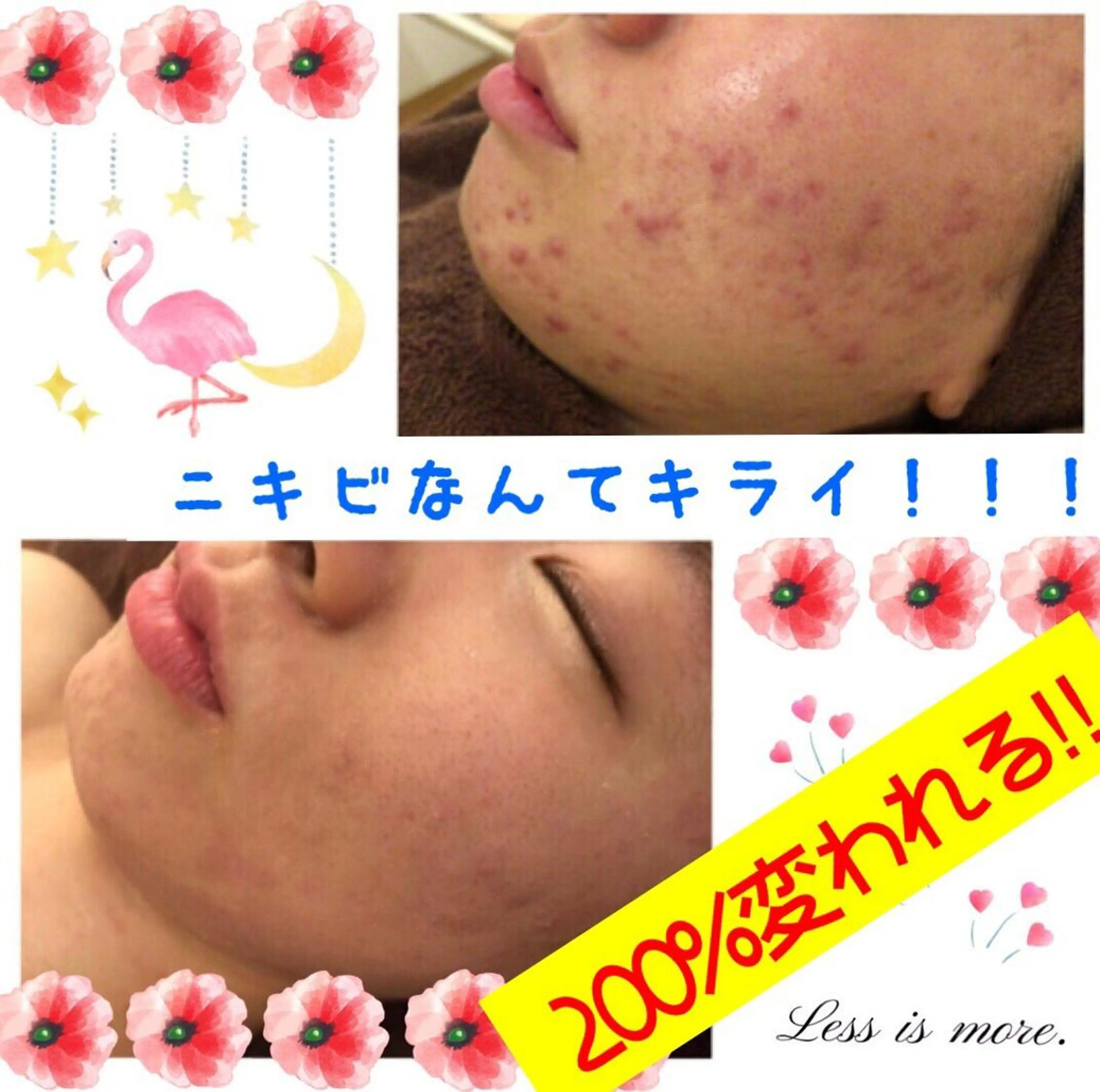 ロング カラー パーマ ヘアアレンジ メンズ キッズ ネイル マツエク・マツパ 四つ星サロン🎖 腸＆ニキビケアに特化のエステ・リラクイメージ