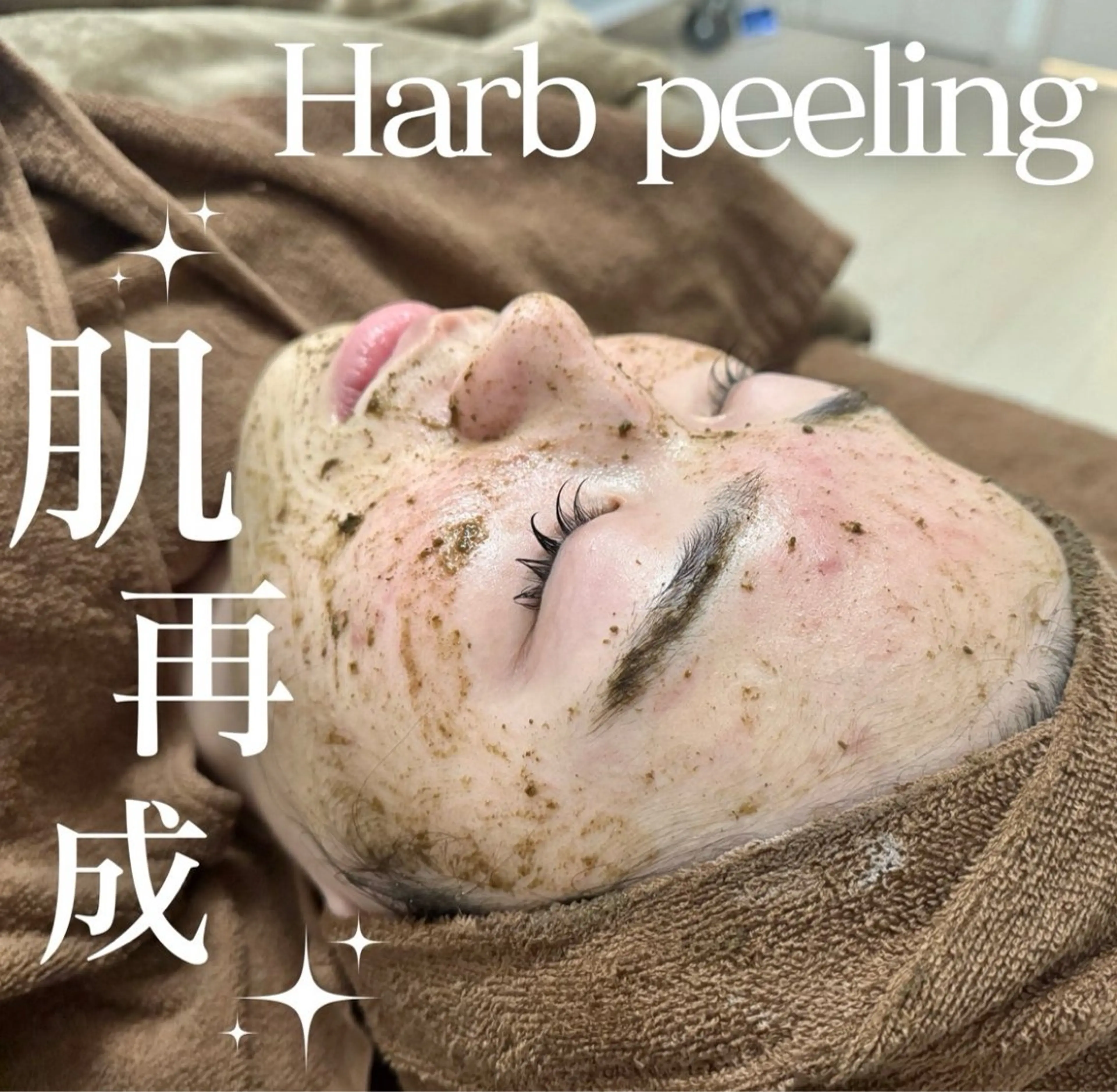 人気No.1👑【剥けない♪本格ニキビケア】話題の陶器肌ハーブピーリング✨敏感肌の方にも安心◎の写真