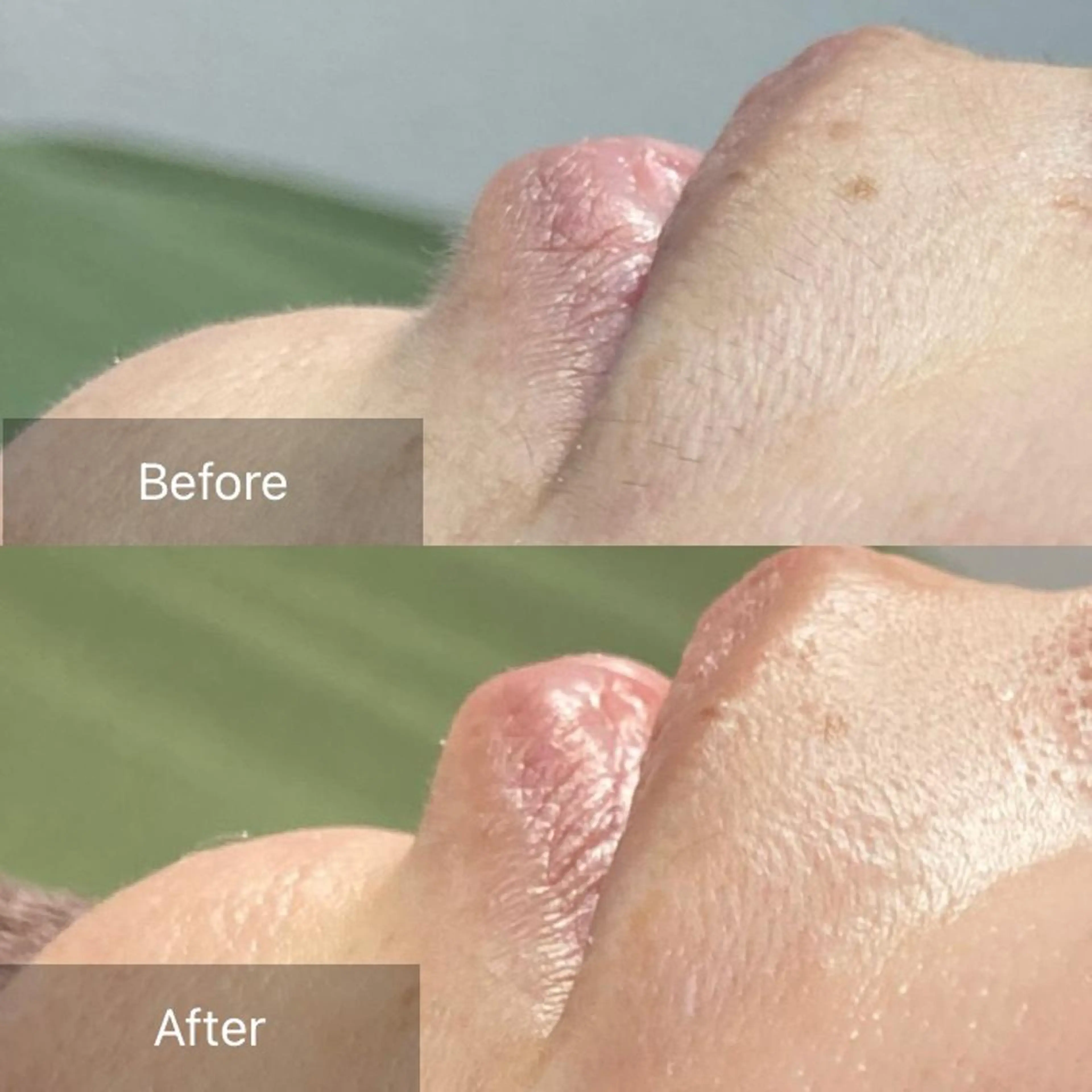 脱毛 産毛専門店 Bittoのエステ・リラクイメージ