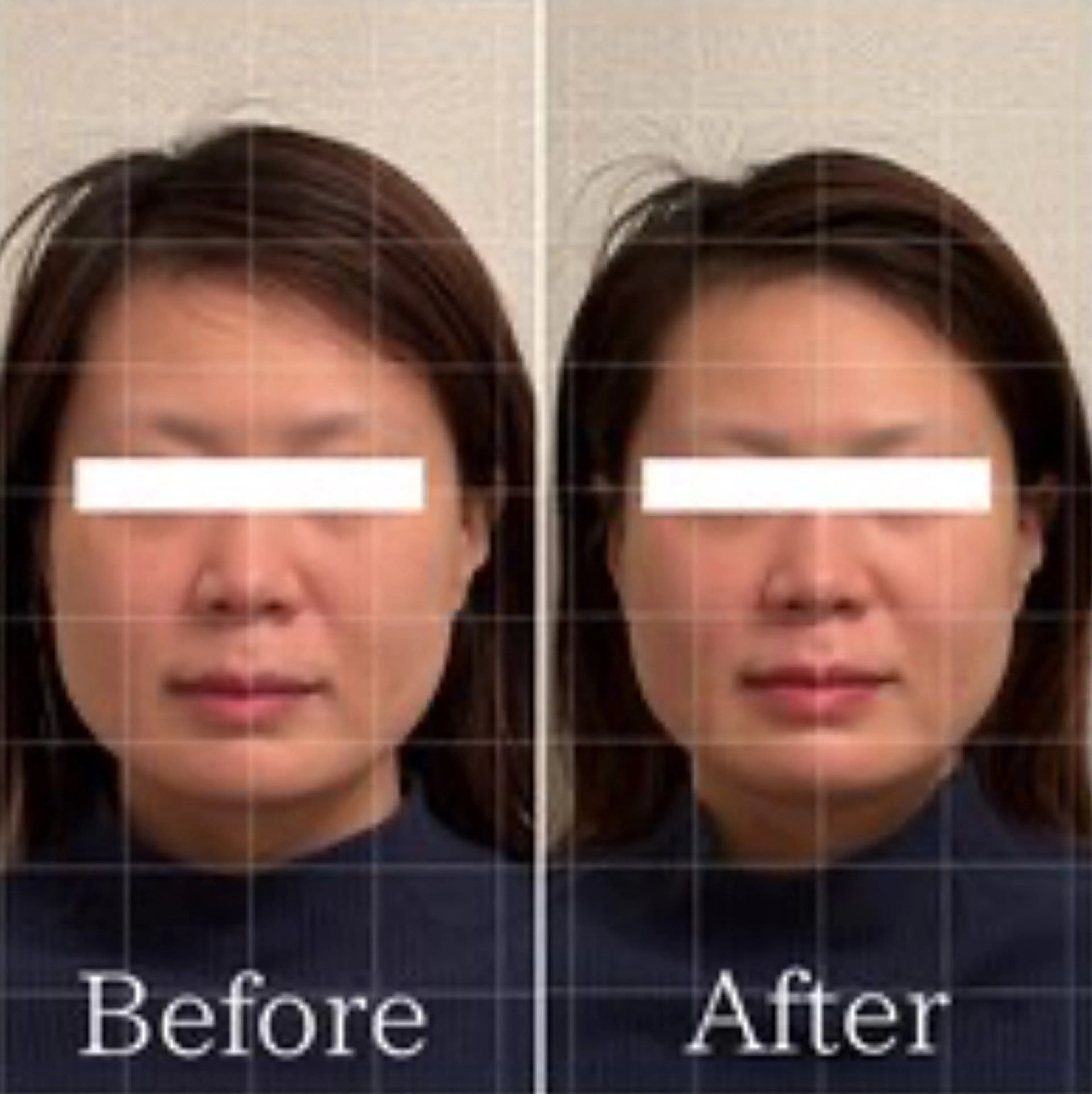 Lily luce 美骨小顔矯正のその他イメージ