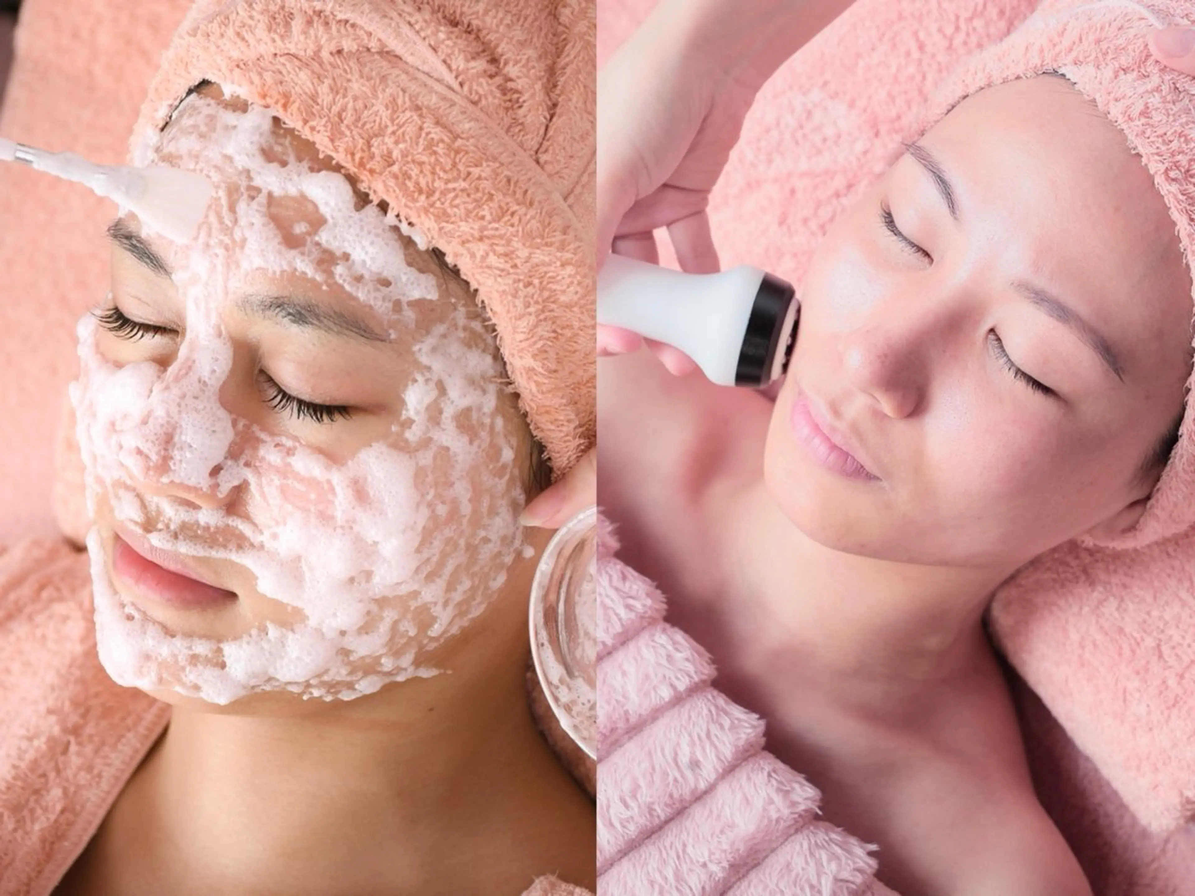 【成人式前スペシャル】毛穴洗浄＋シフォンピーリング＋エレクトロポレーション(高濃度美容液導入)ダウンタイムなし✨の写真