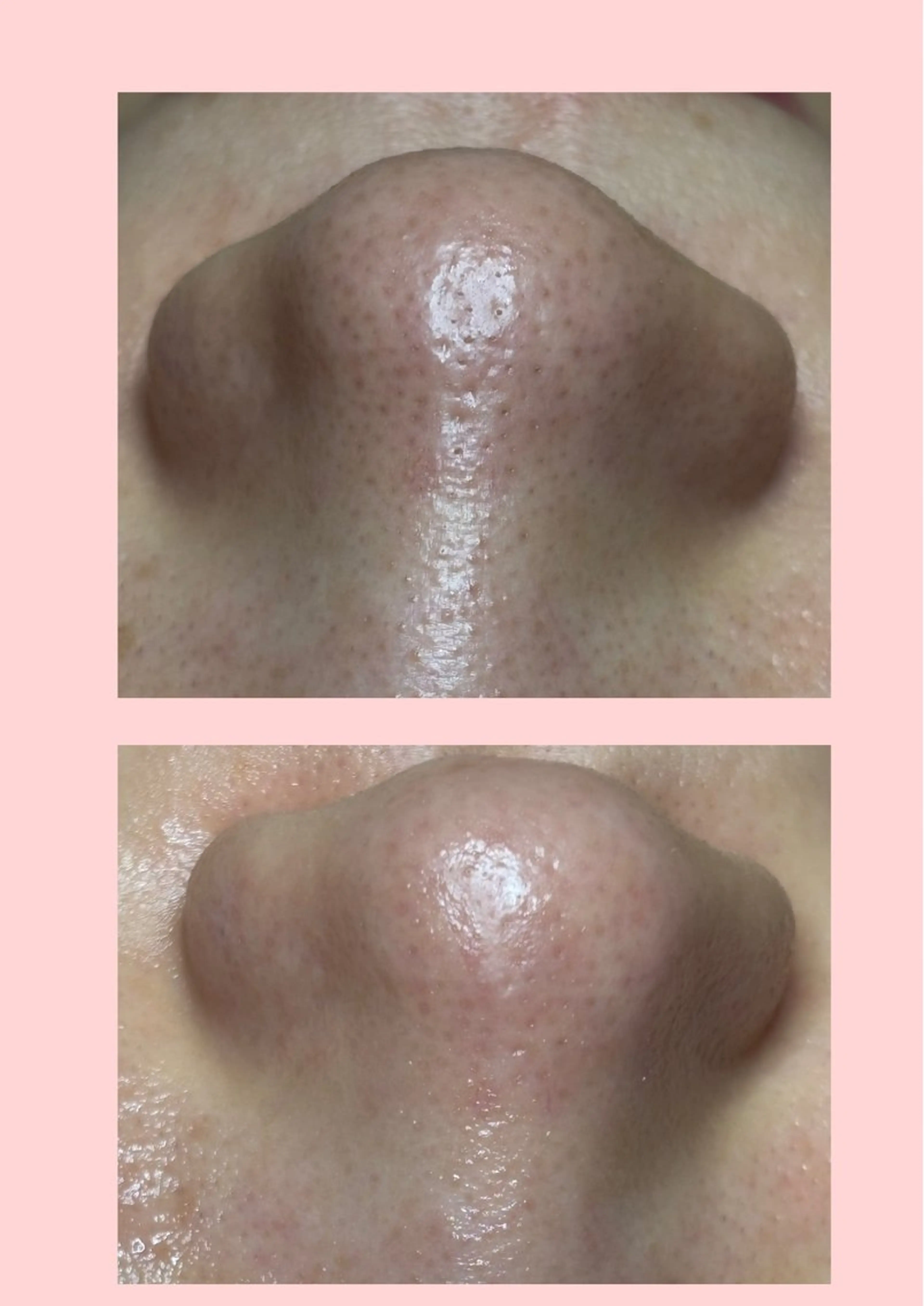 beauty salon N.11所属・beauty salonN.11のエステ・リラクイメージ