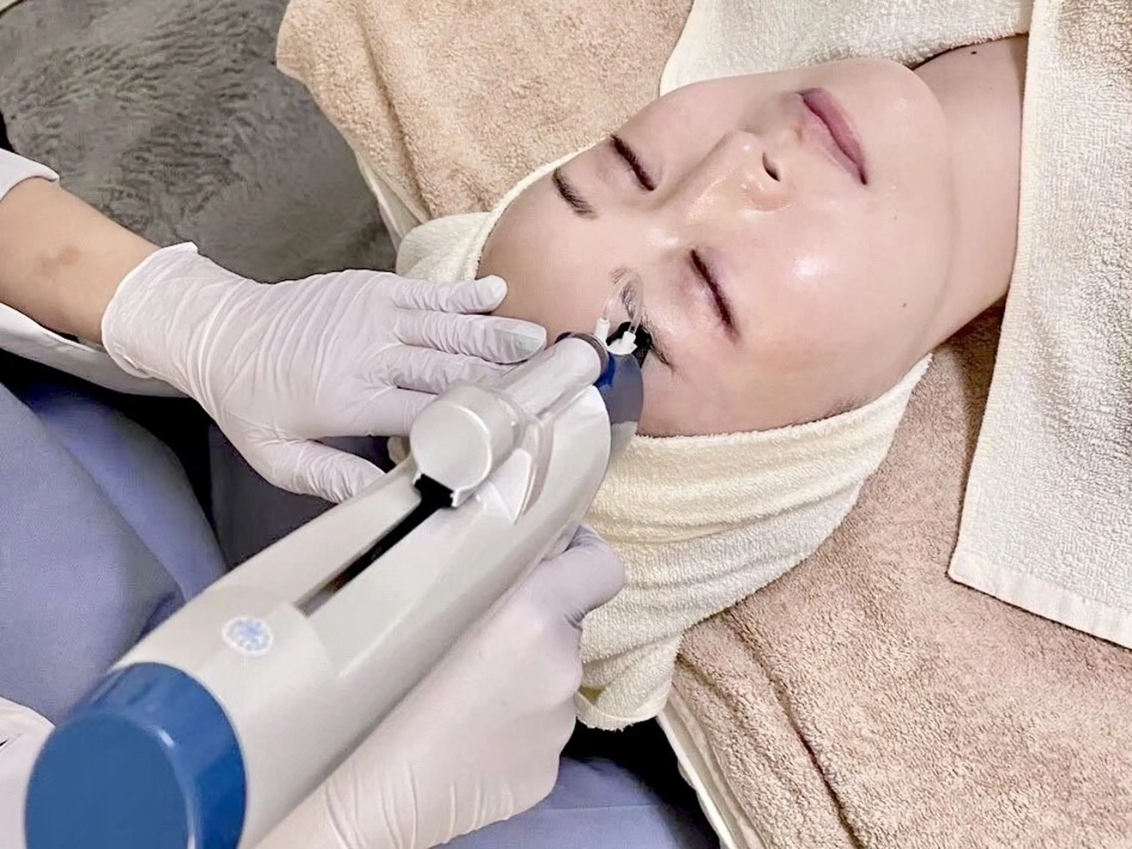 再生プログラム◆艶美肌管理 《臍帯エクソソーム“水光ジェット”×デコルテリンパ×ヘッド》通常19,500→16,500円の写真