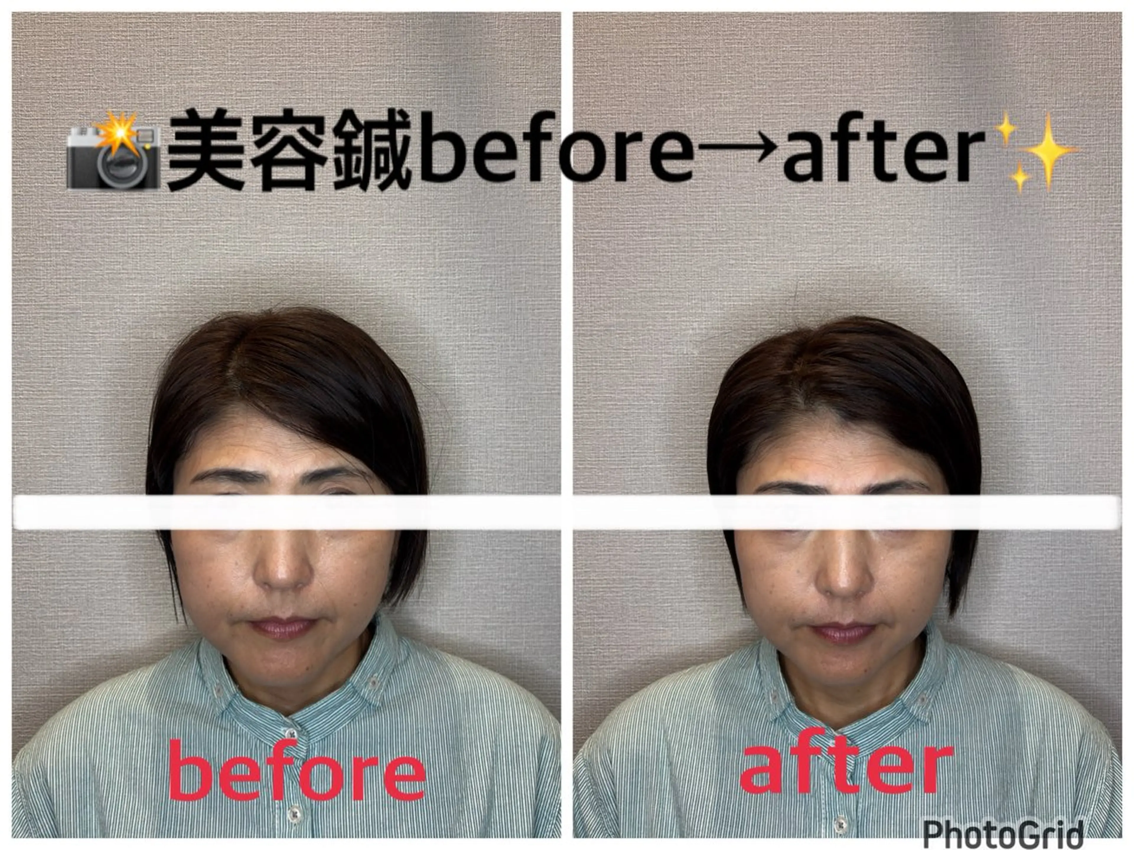 その他 小林整骨院本町 美容鍼roomのエステ・リラクイメージ