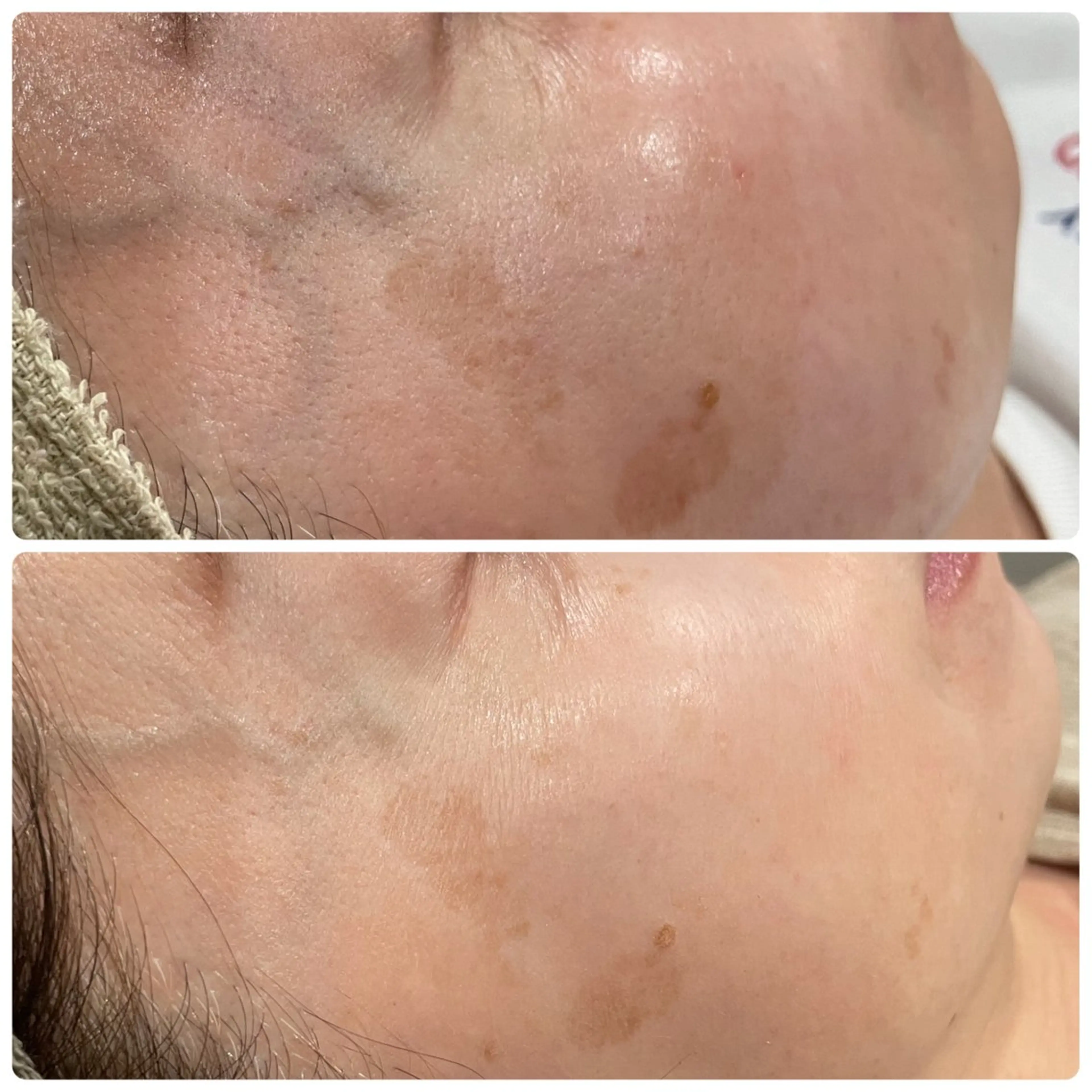 LiZA エステティックサロンのその他イメージ