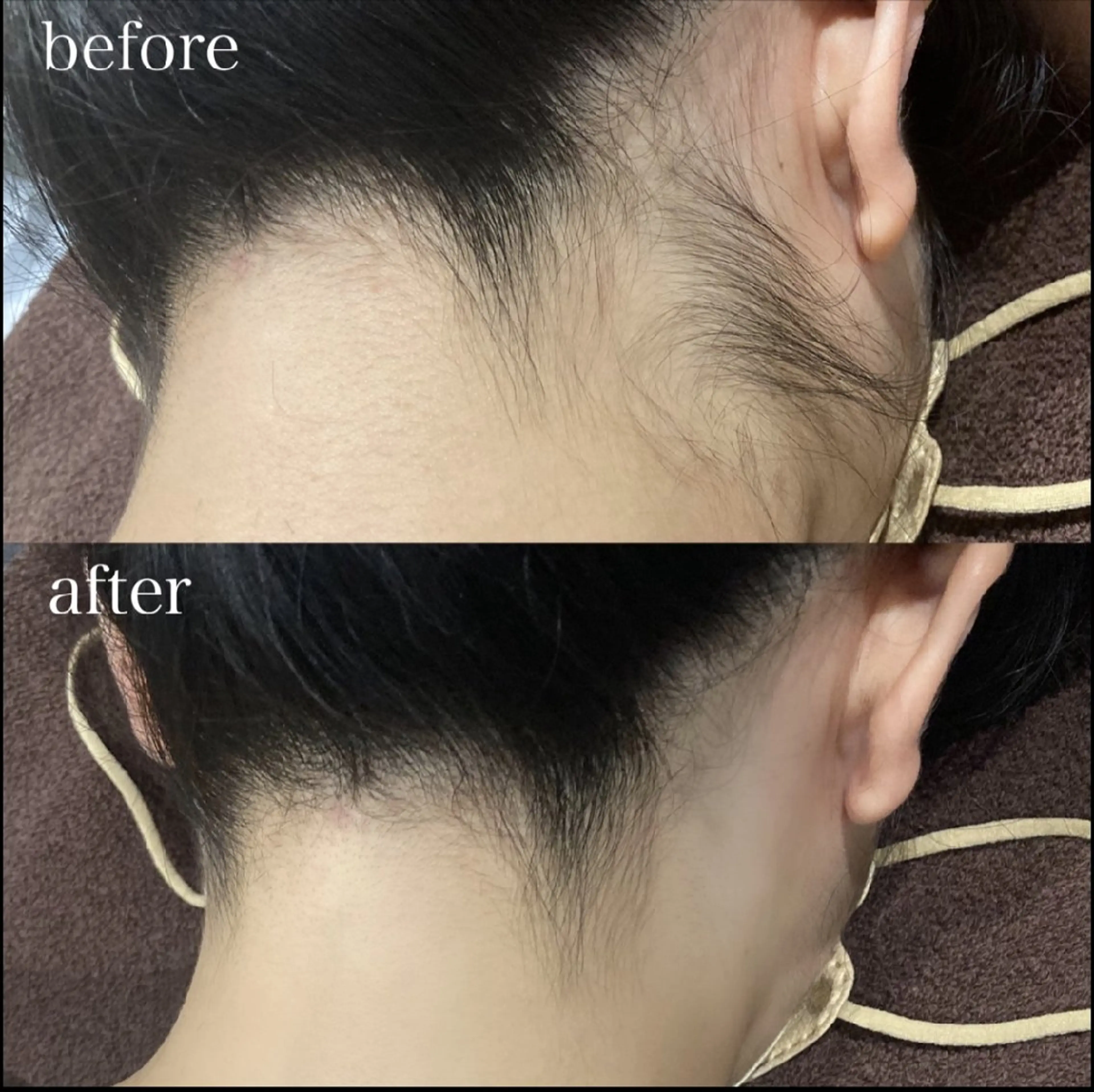 脱毛 DahliaBeauty ダリアビューティー所属・Dahlia 痩身 フェイシャル 中村のエステ・リラクイメージ