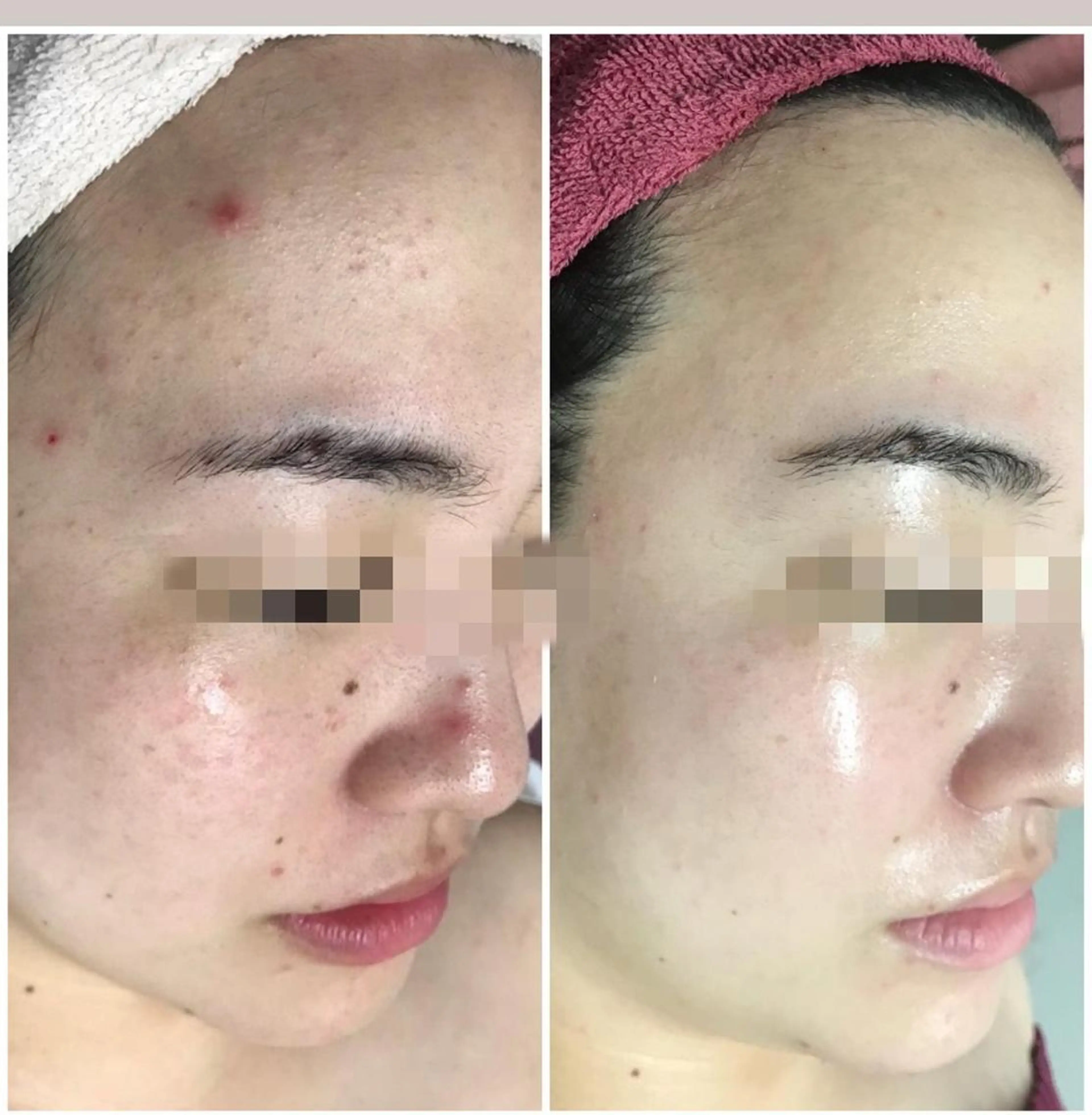 美まつ毛と美肌サロン lavjuのマツエク・マツパデザイン