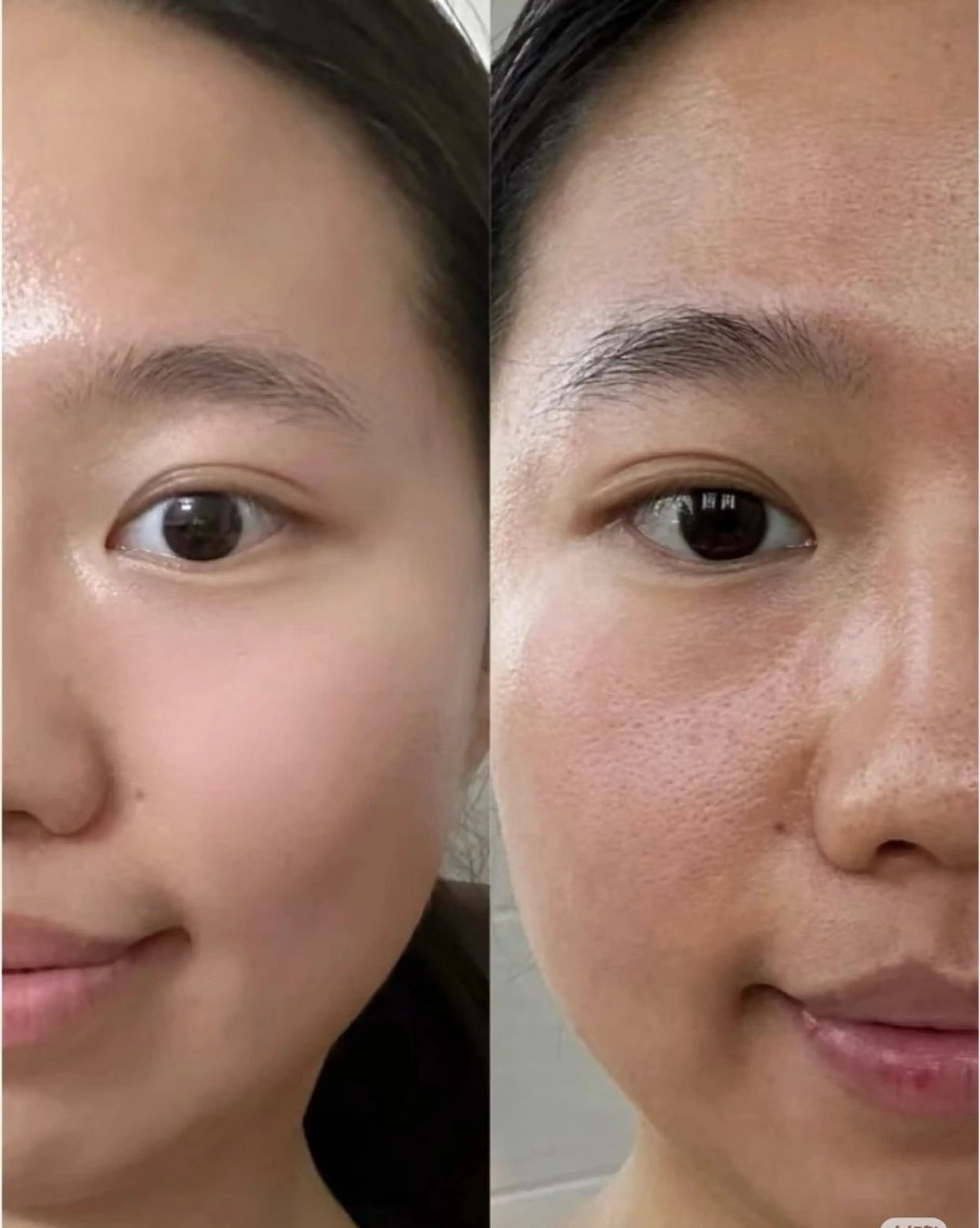 ネイル エステ aliaハイフ&水光ジェットサロン所属・aliaハーブ水光店 エステティシャン募集のエステ・リラクイメージ