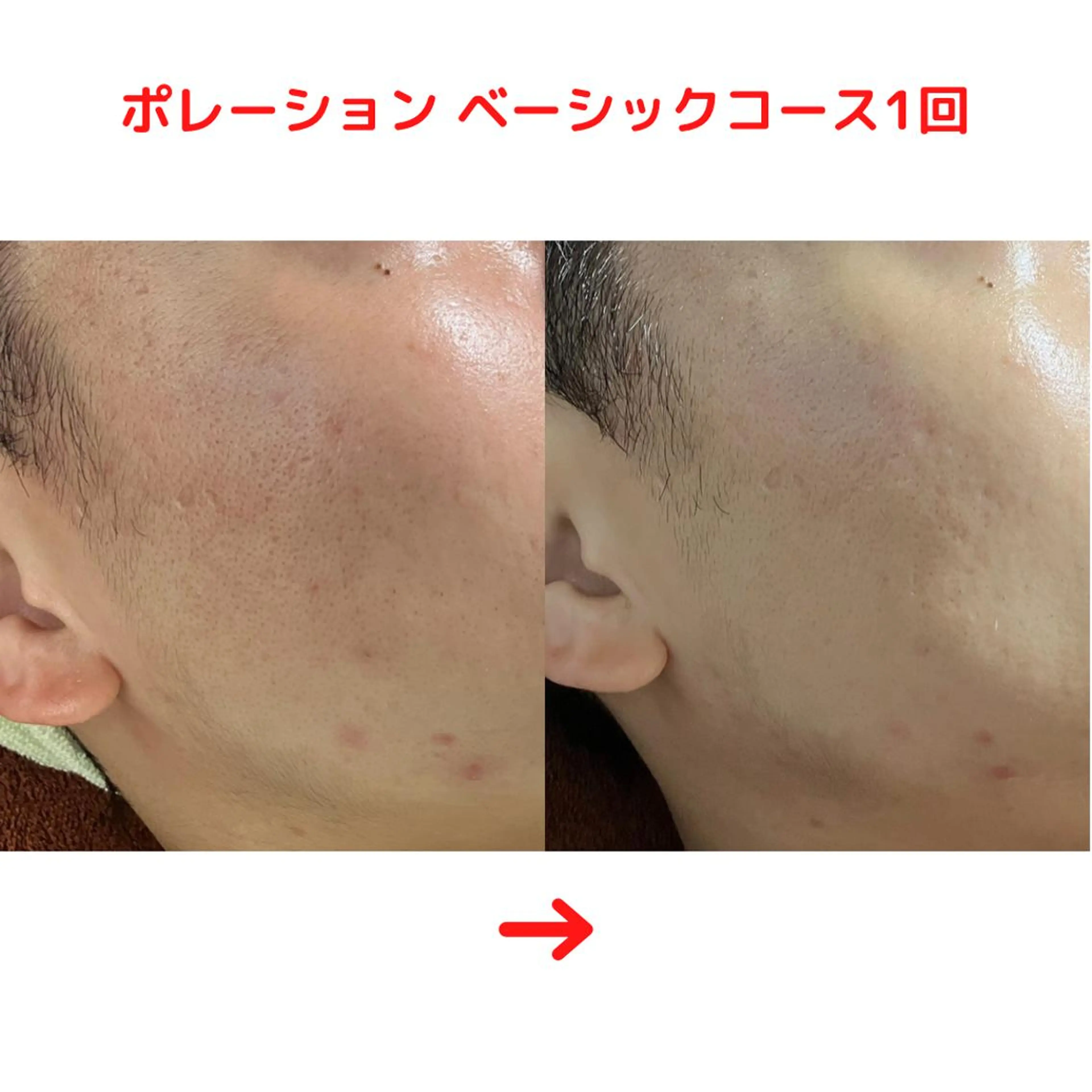 ミューズエステ 谷口美結のエステ・リラクイメージ