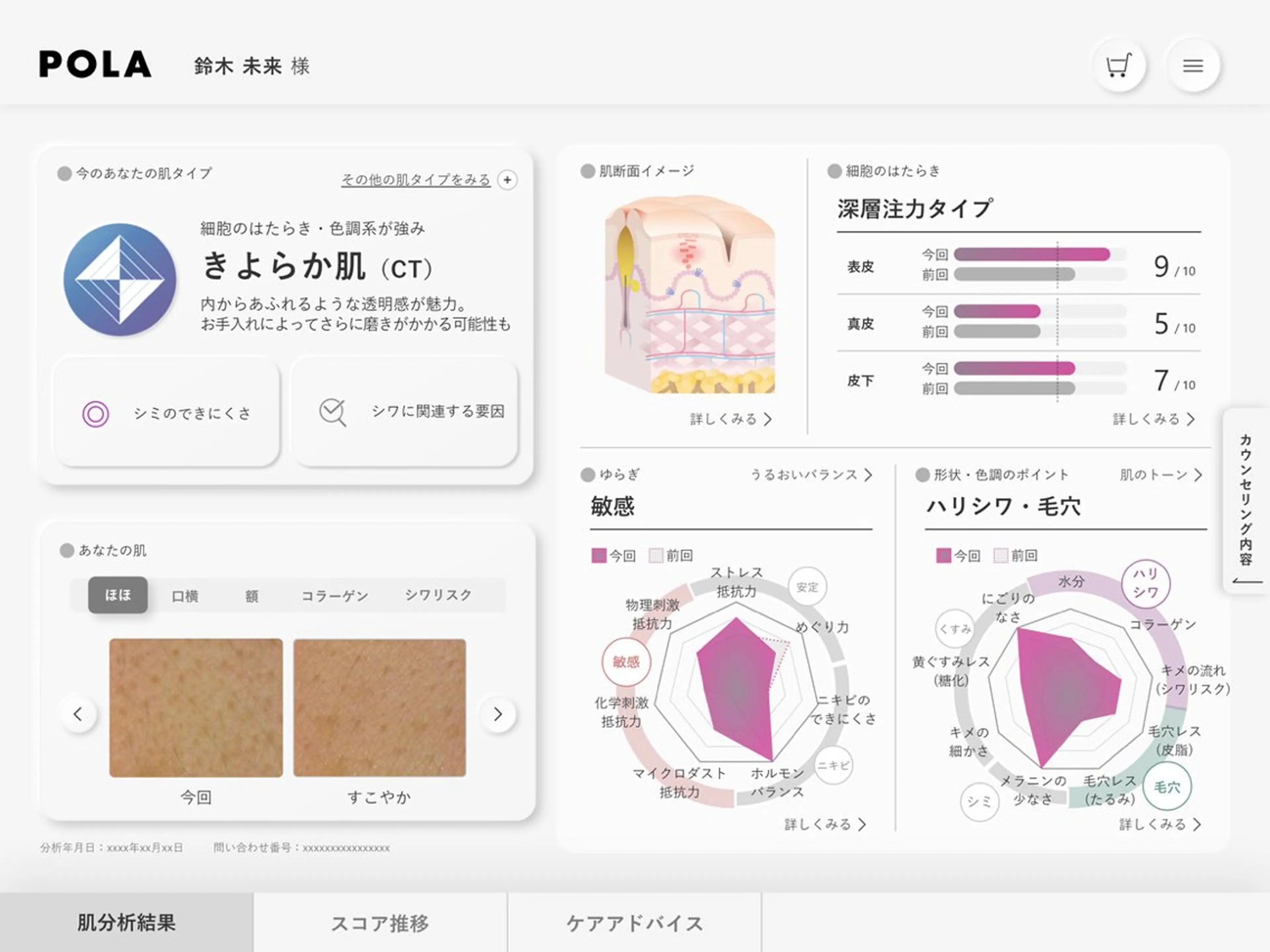 新肌分析付きフェイシャルエステの写真