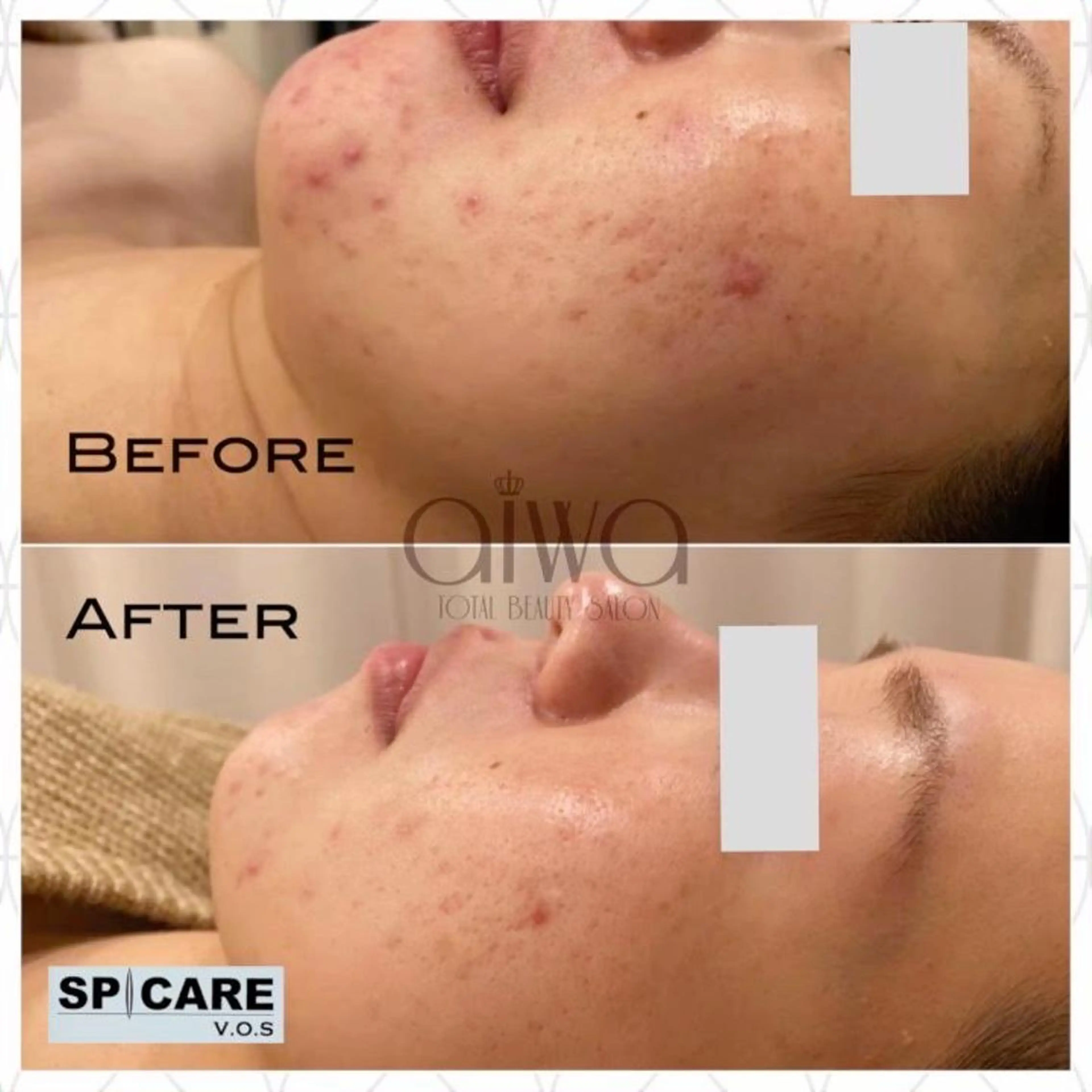 エステ ビューティサロン aiwaのエステ・リラクイメージ