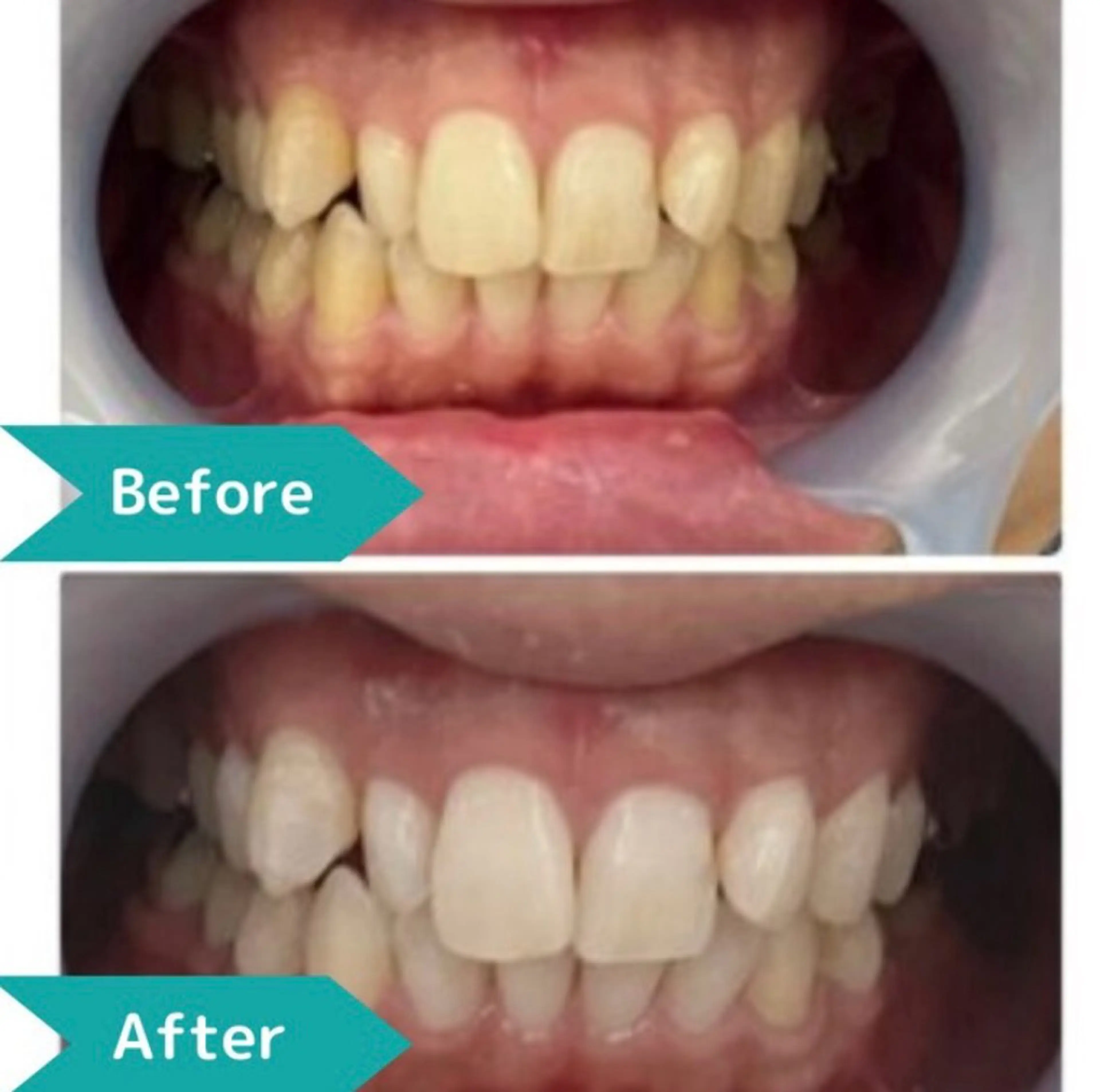 凛 リンのネイルデザイン