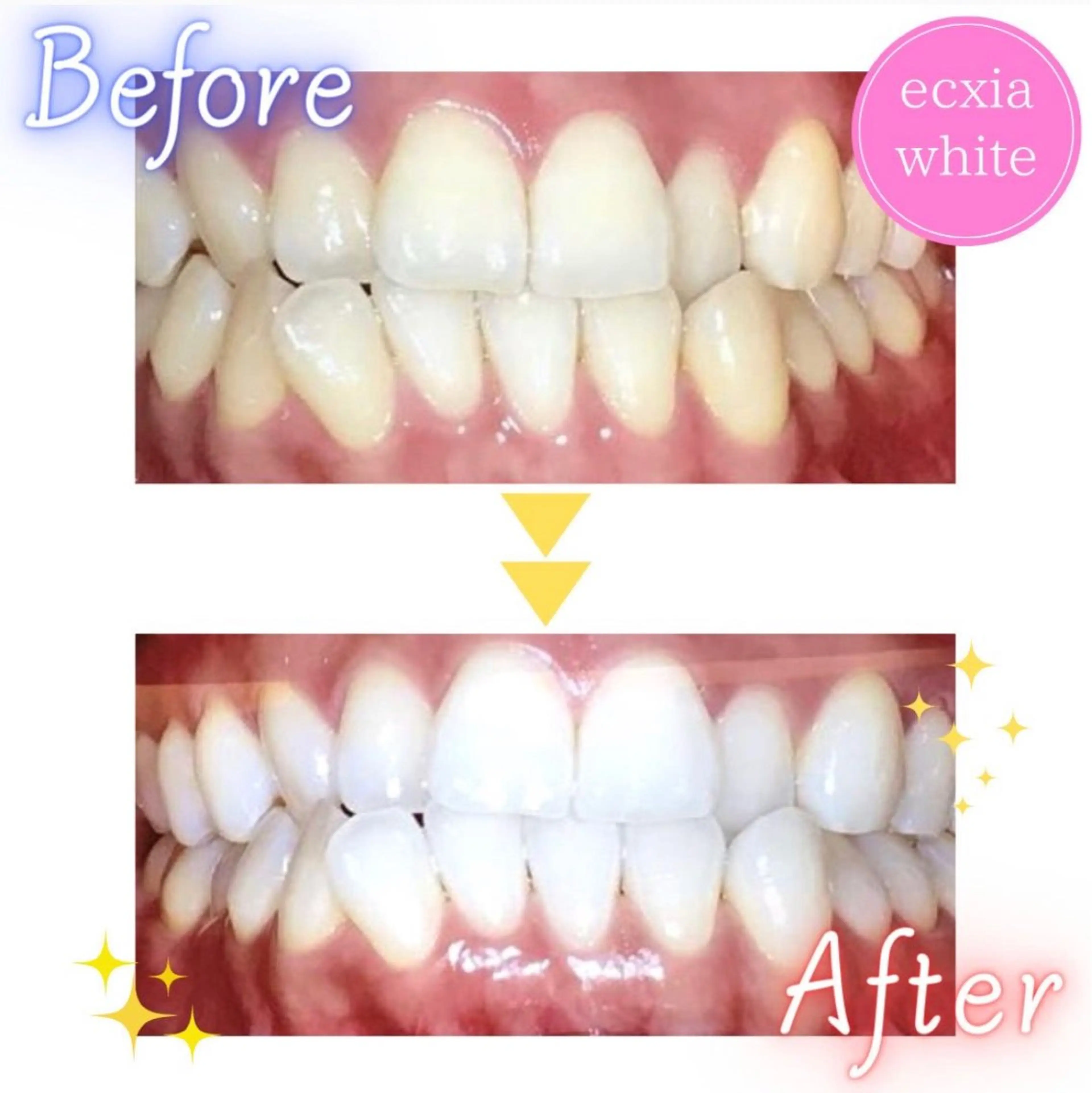 ecxia  white 　広島袋町店所属・セルフホワイトニング エクシア広島袋町店のその他イメージ