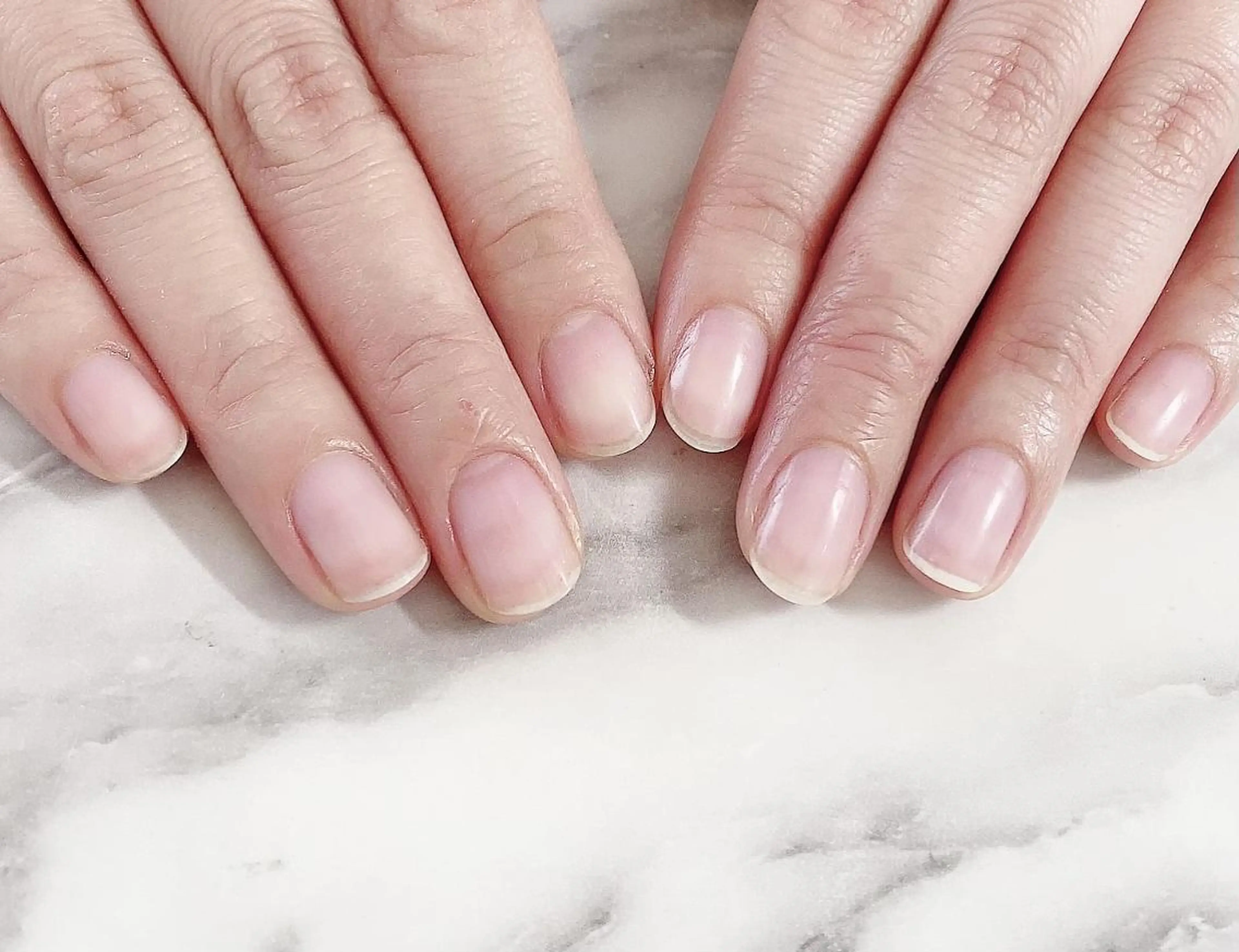 ハンドケアの写真