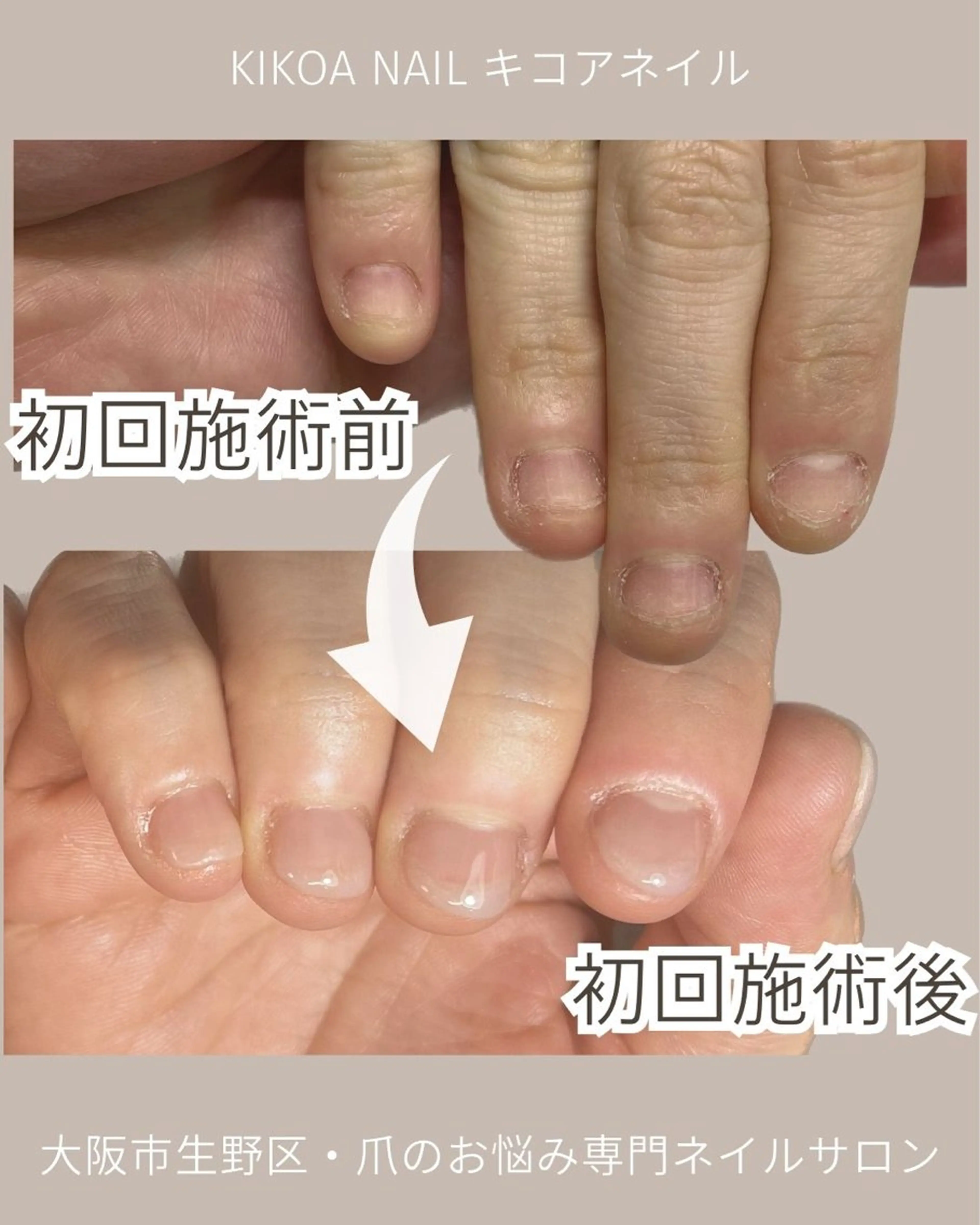 ネイル KIKOA NAIL キコアネイルのネイルデザイン