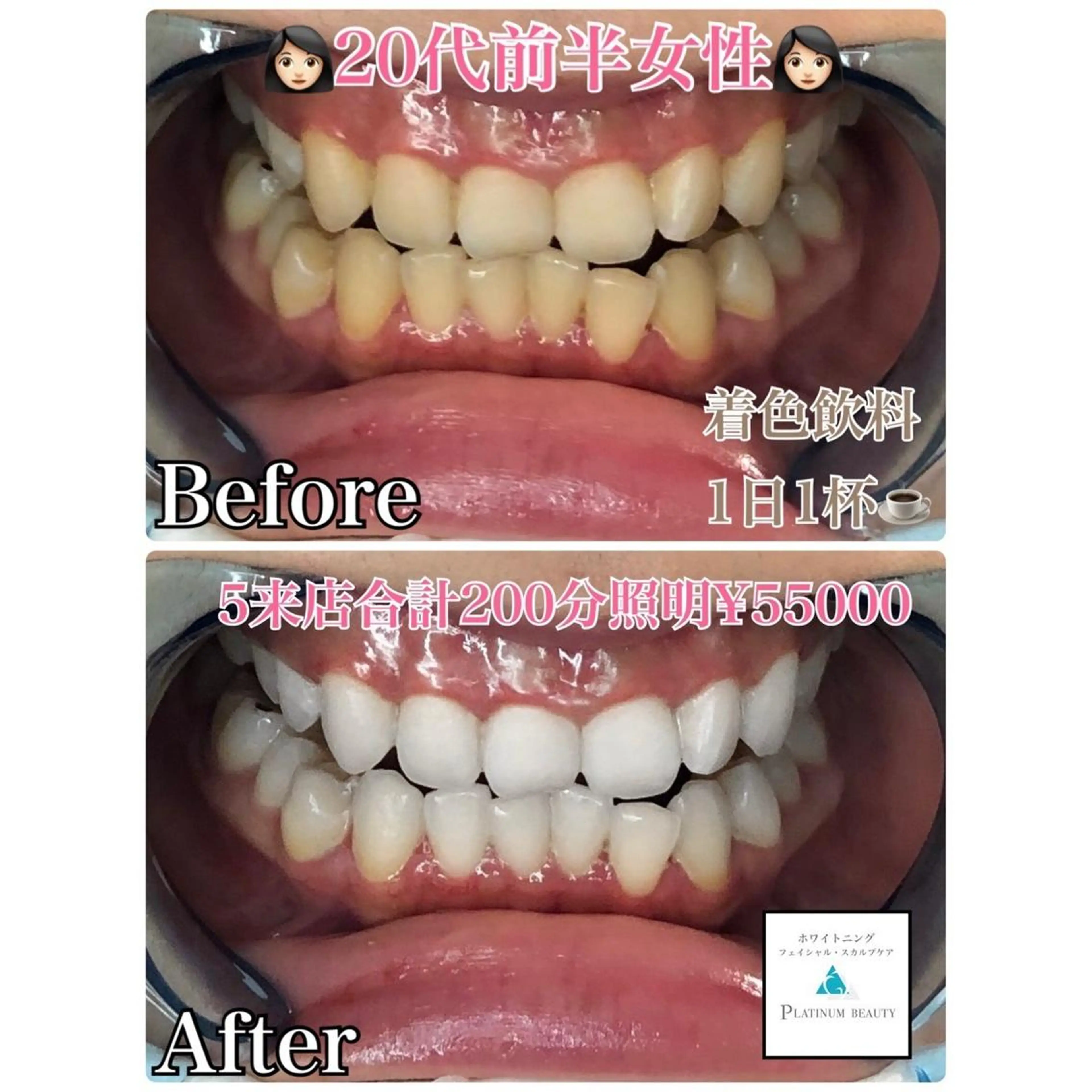 ホワイトニングビューティー西宮店所属・ホワイトニングビュー ティー西宮店のその他イメージ