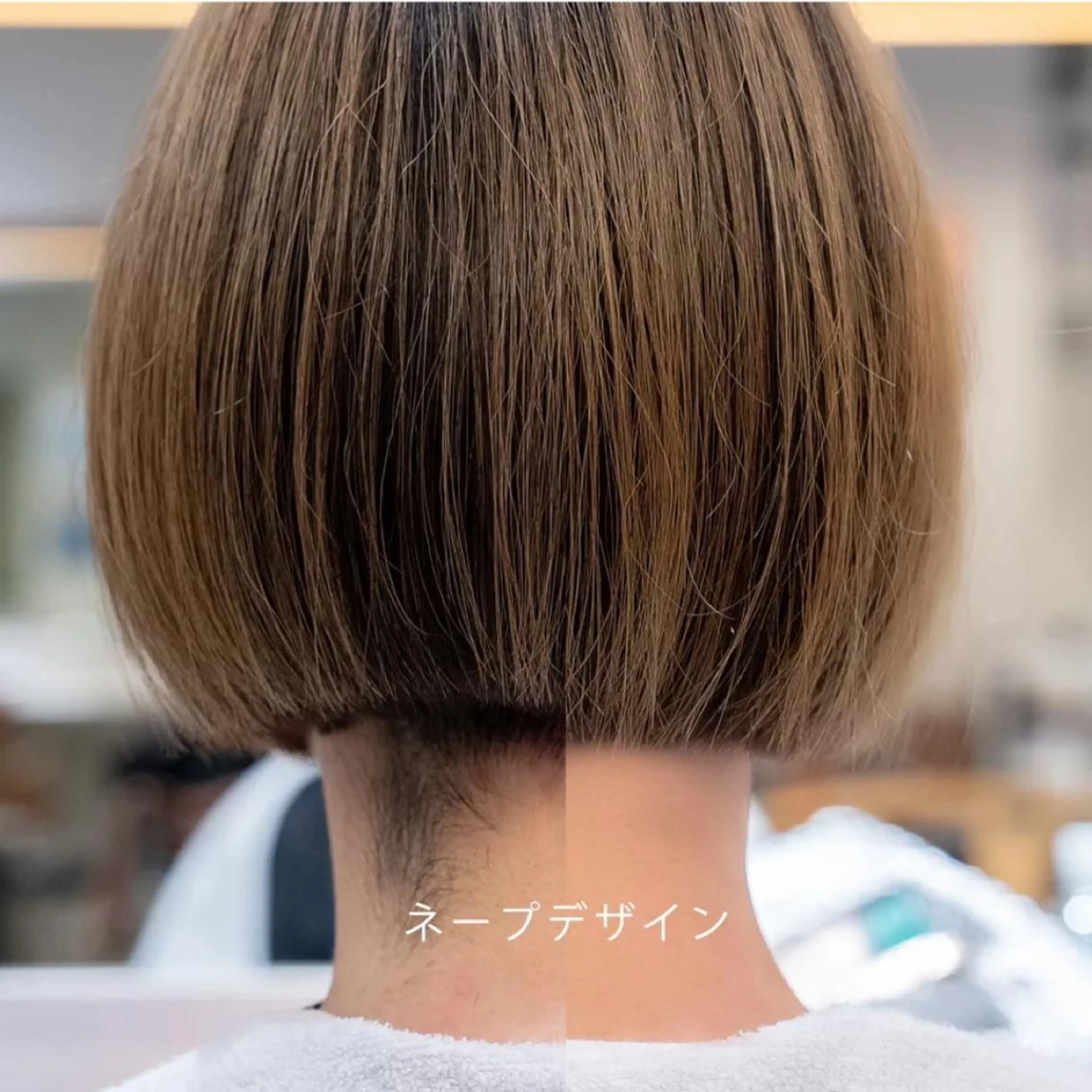 かっこいい後ろ姿に！うなじ光脱毛の写真