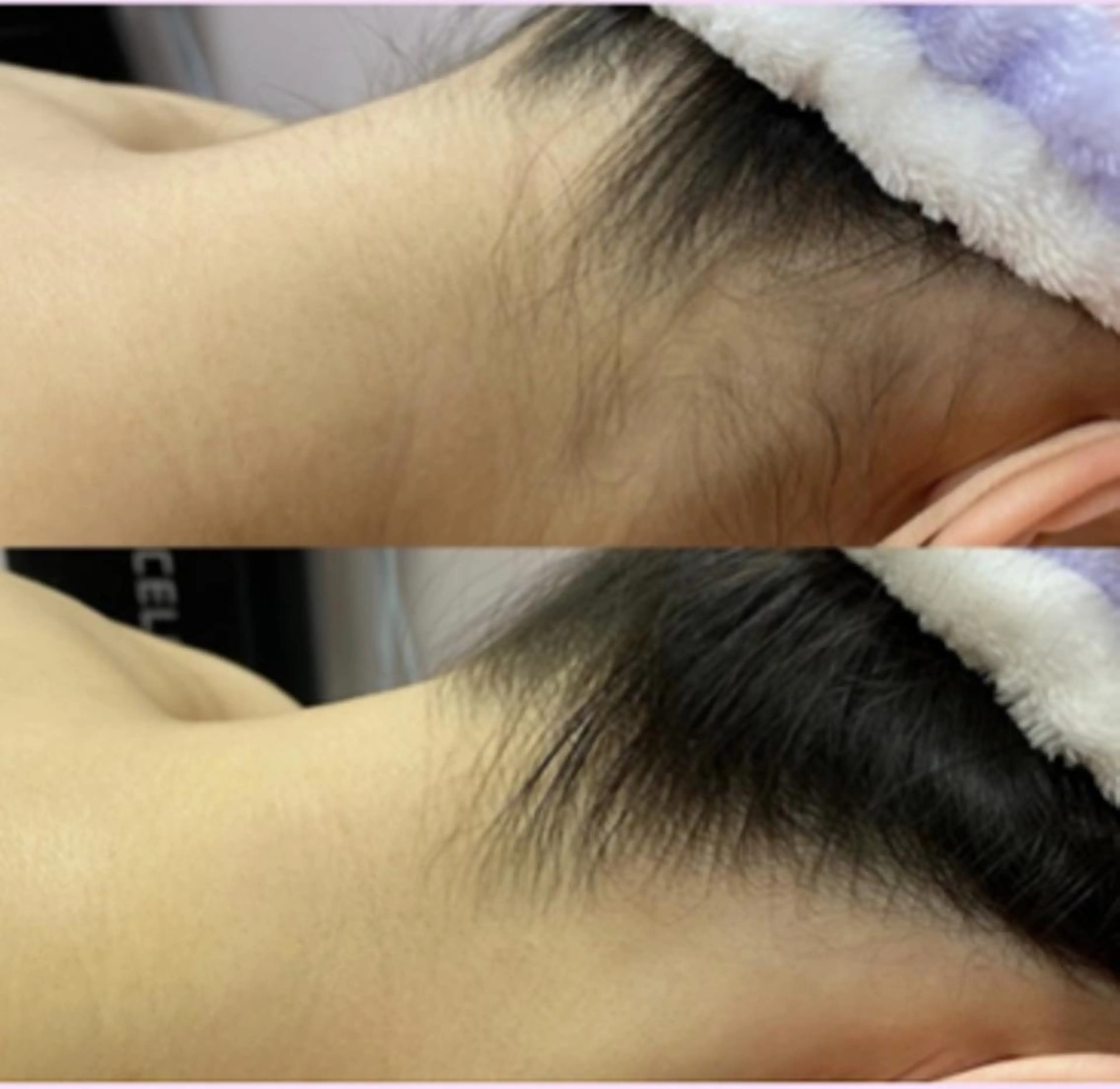 全身脱毛×マッサージ 高岳×新栄×代官町の眉毛・アイブロウイメージ