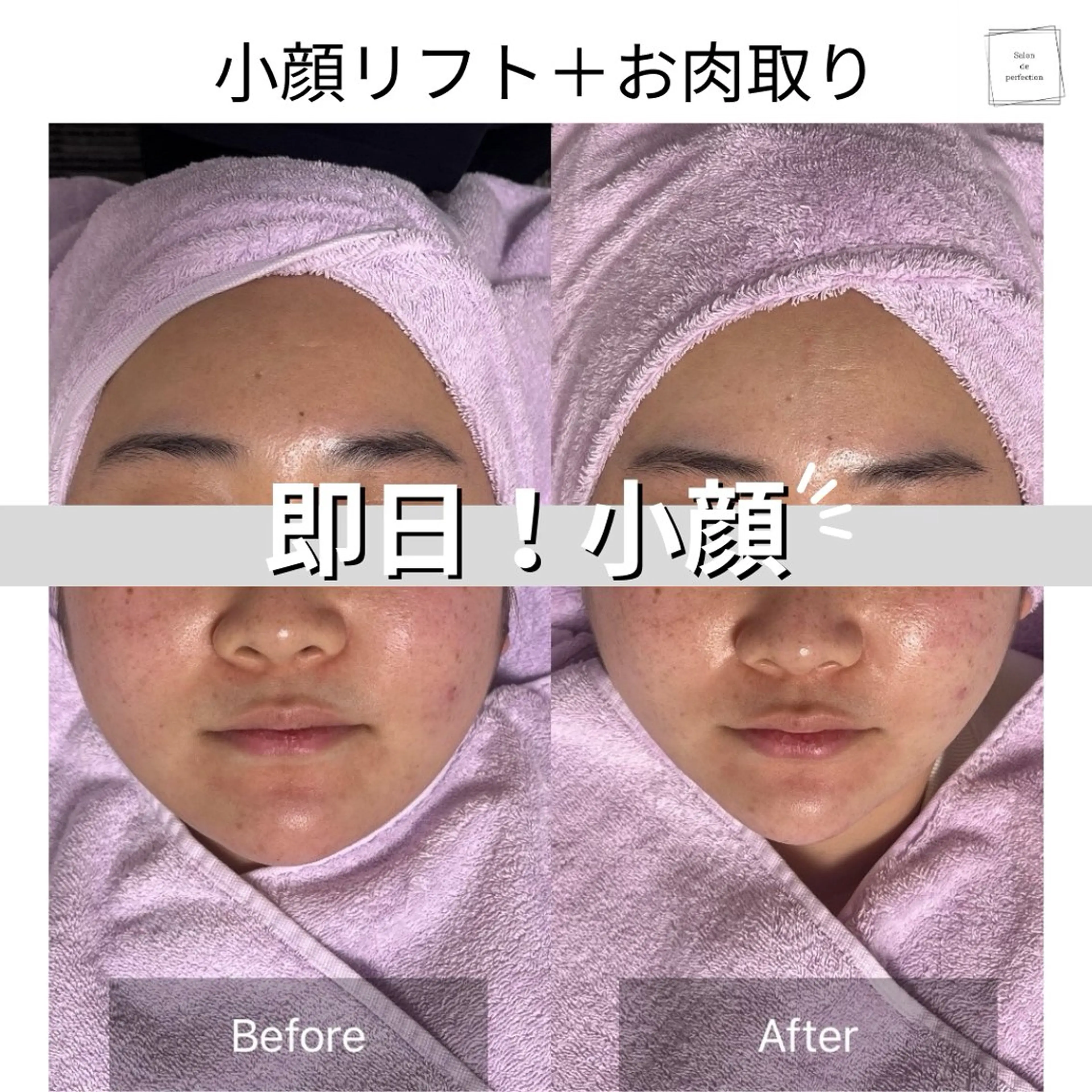 エステ salon de perfectionのエステ・リラクイメージ