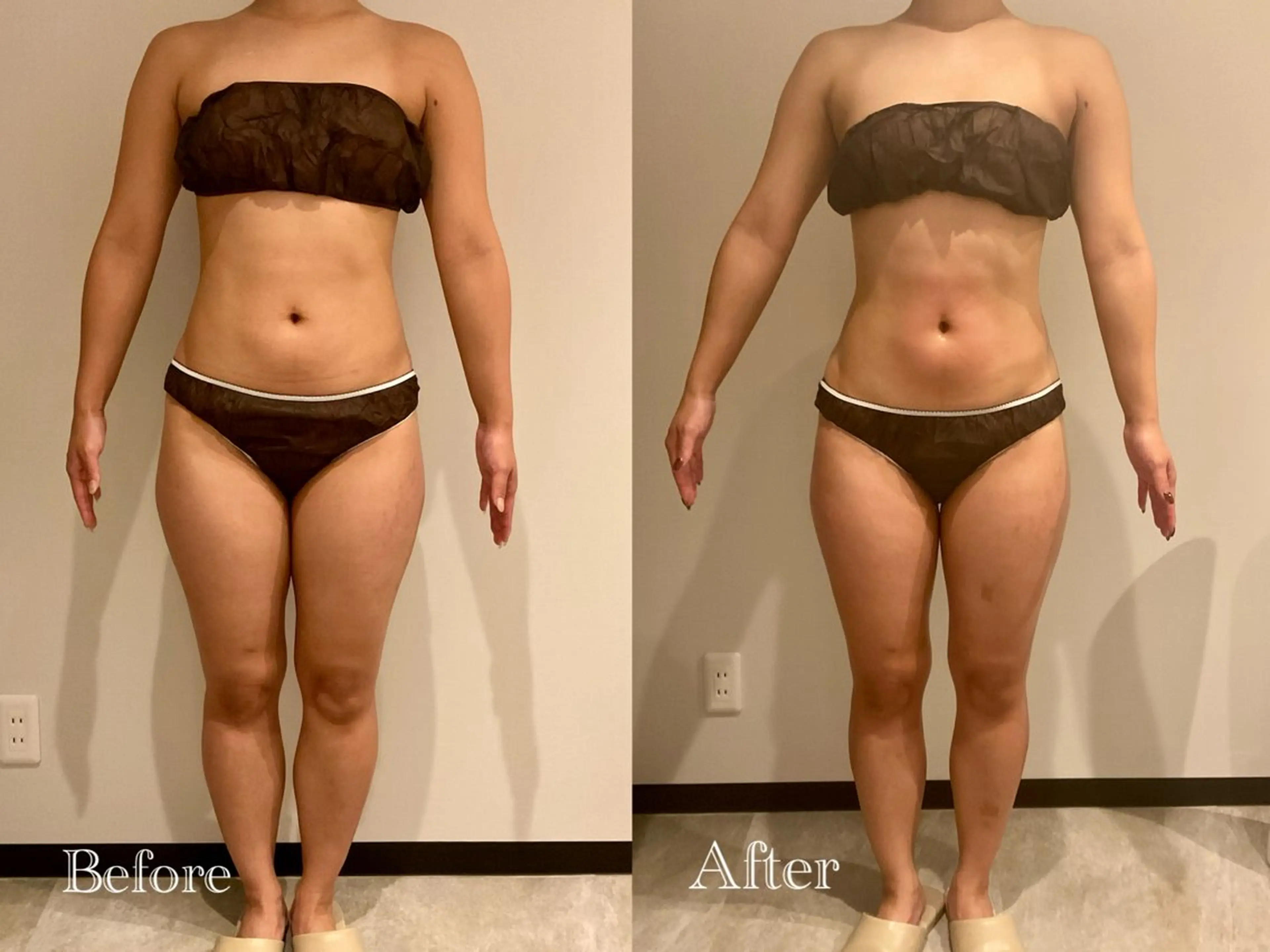 Esthetic MiEUXのエステ・リラクイメージ