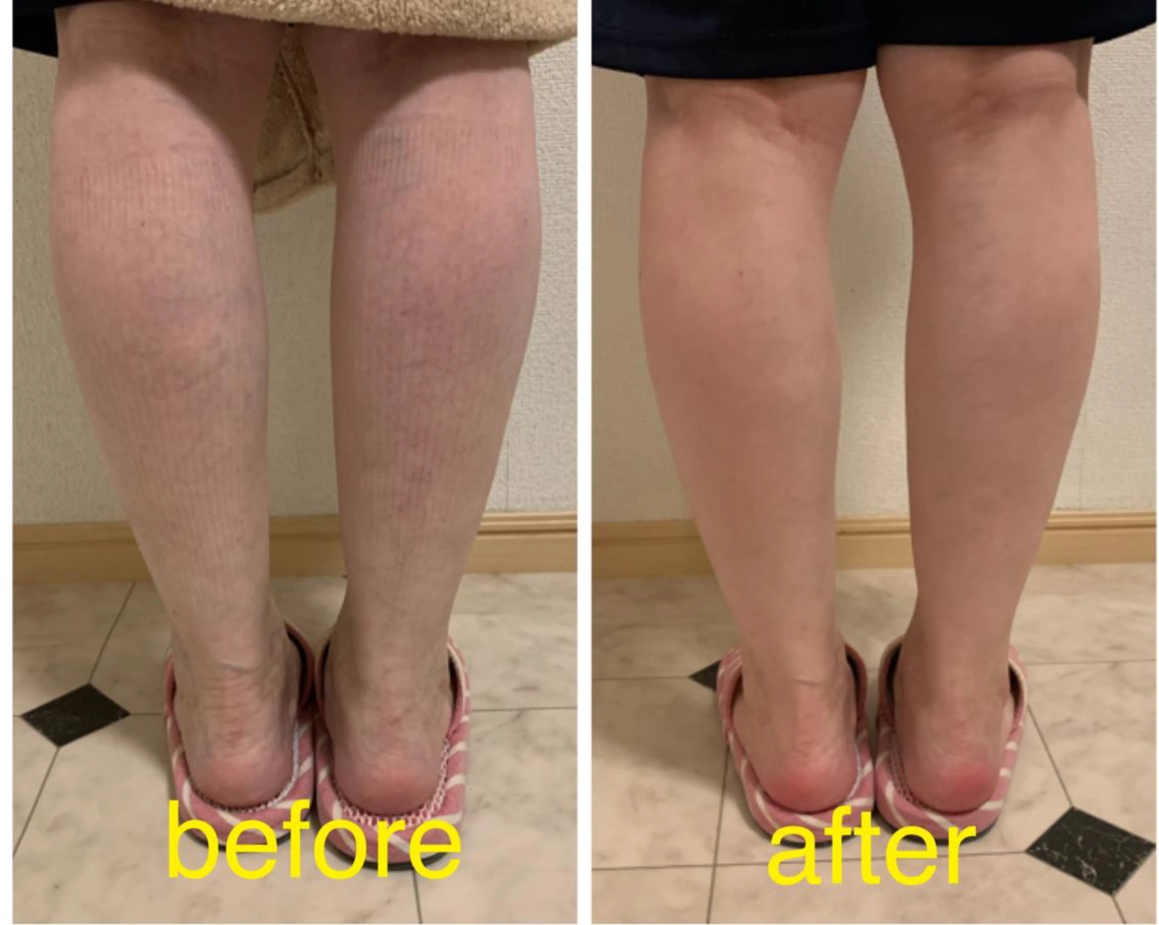 lupo エステ.ネイルのエステ・リラクイメージ