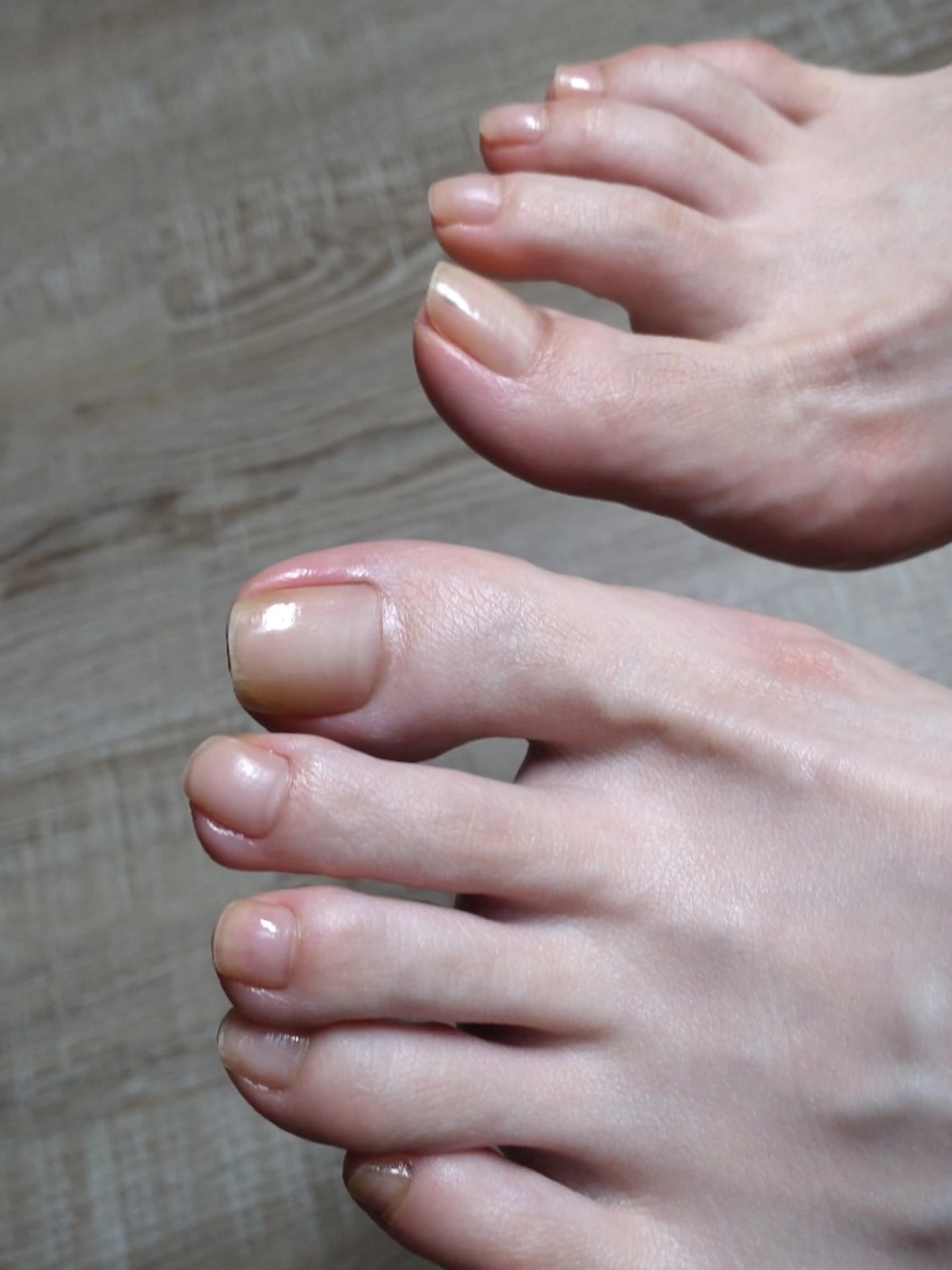 フット : フットケアの写真