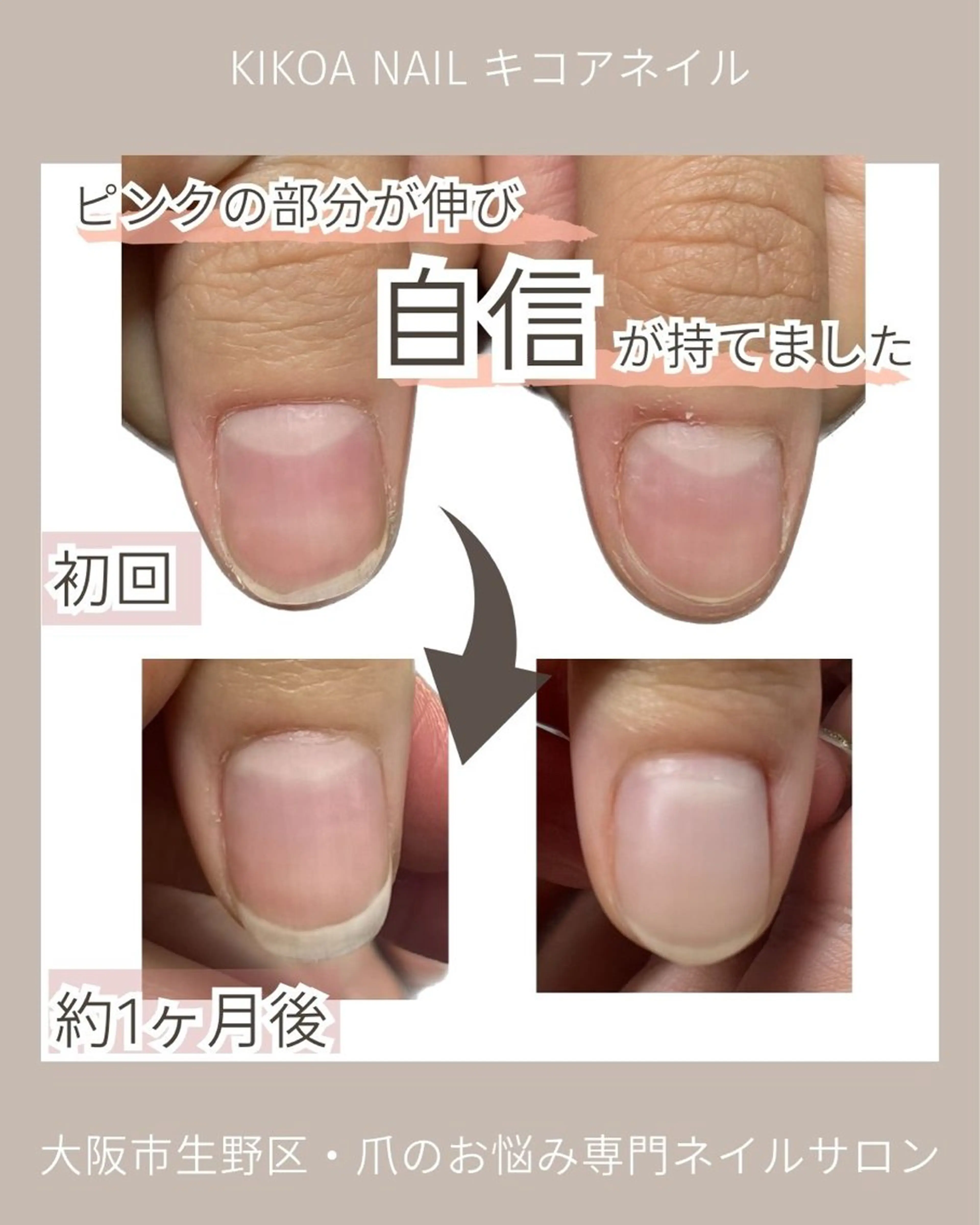 ネイル KIKOA NAIL キコアネイルのネイルデザイン
