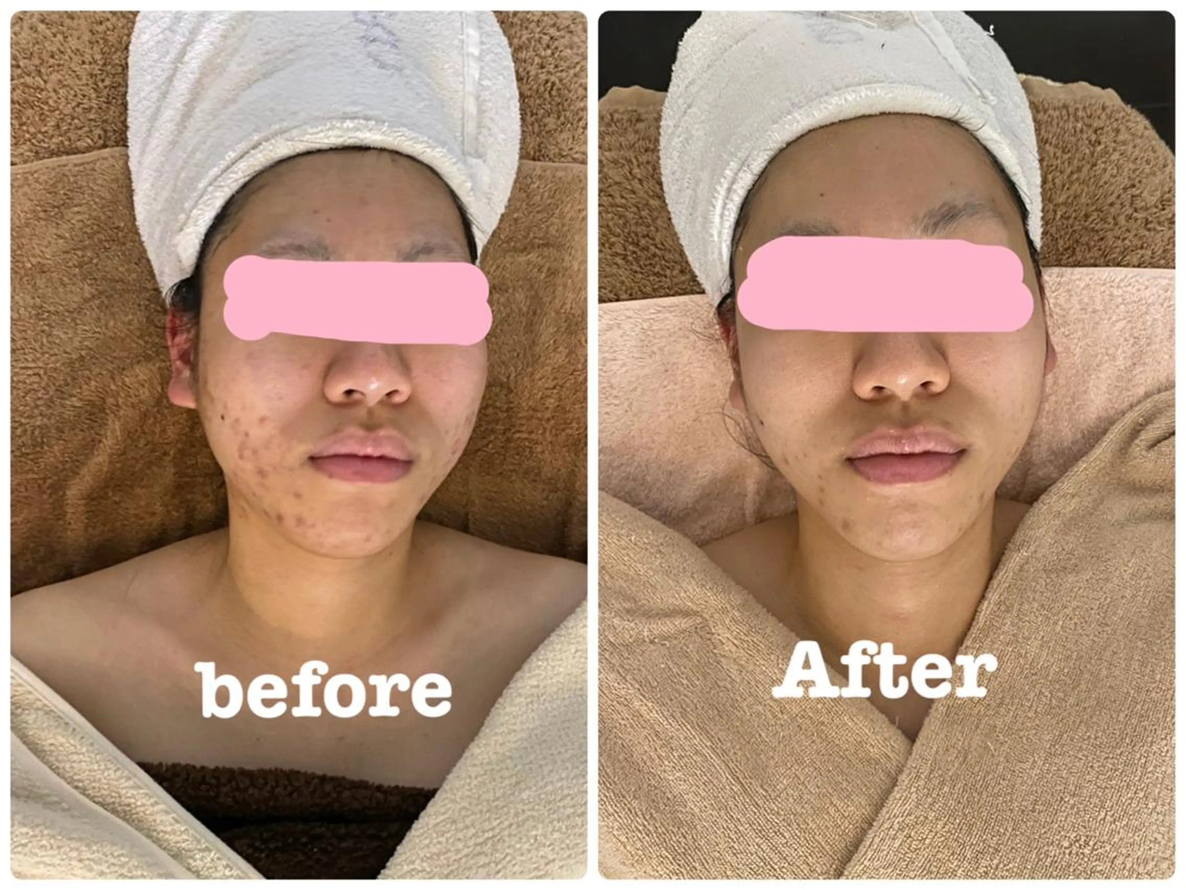 短期集中セット‼️(3ヶ月分) 本気でお肌変えたい方‼️の写真