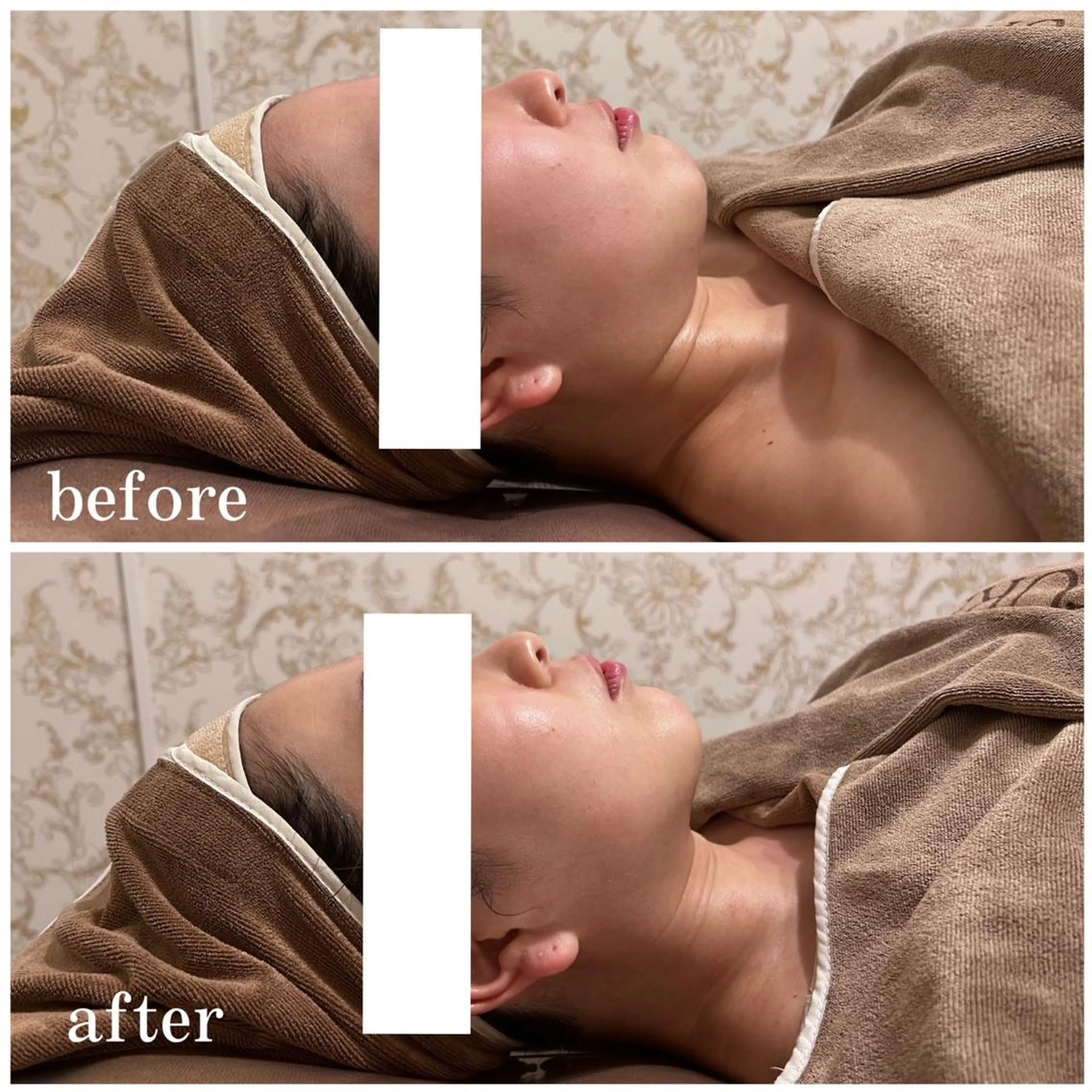 西区九条エステ MITUREIサロンのエステ・リラクイメージ