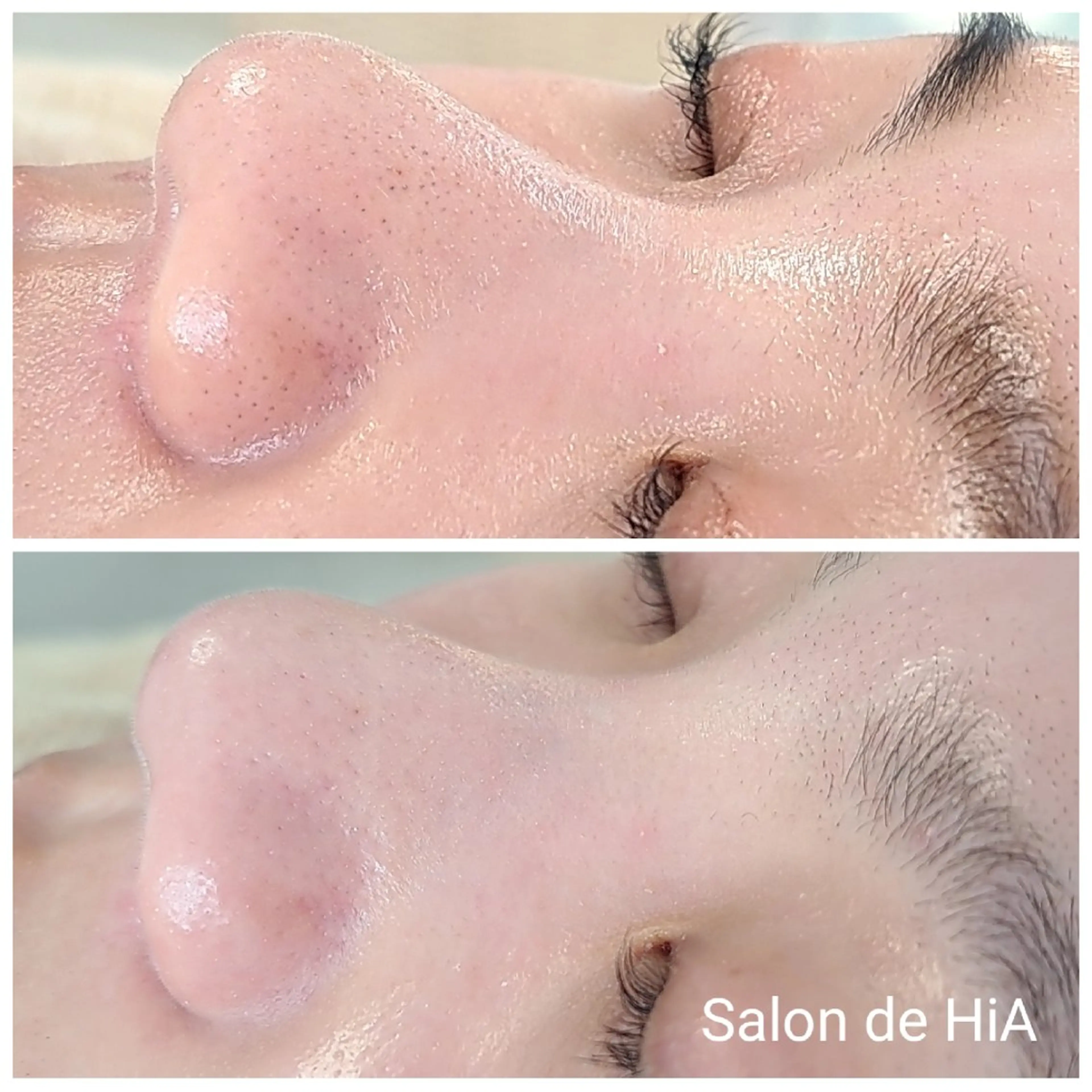 エステ Salon de  HiAのエステ・リラクイメージ