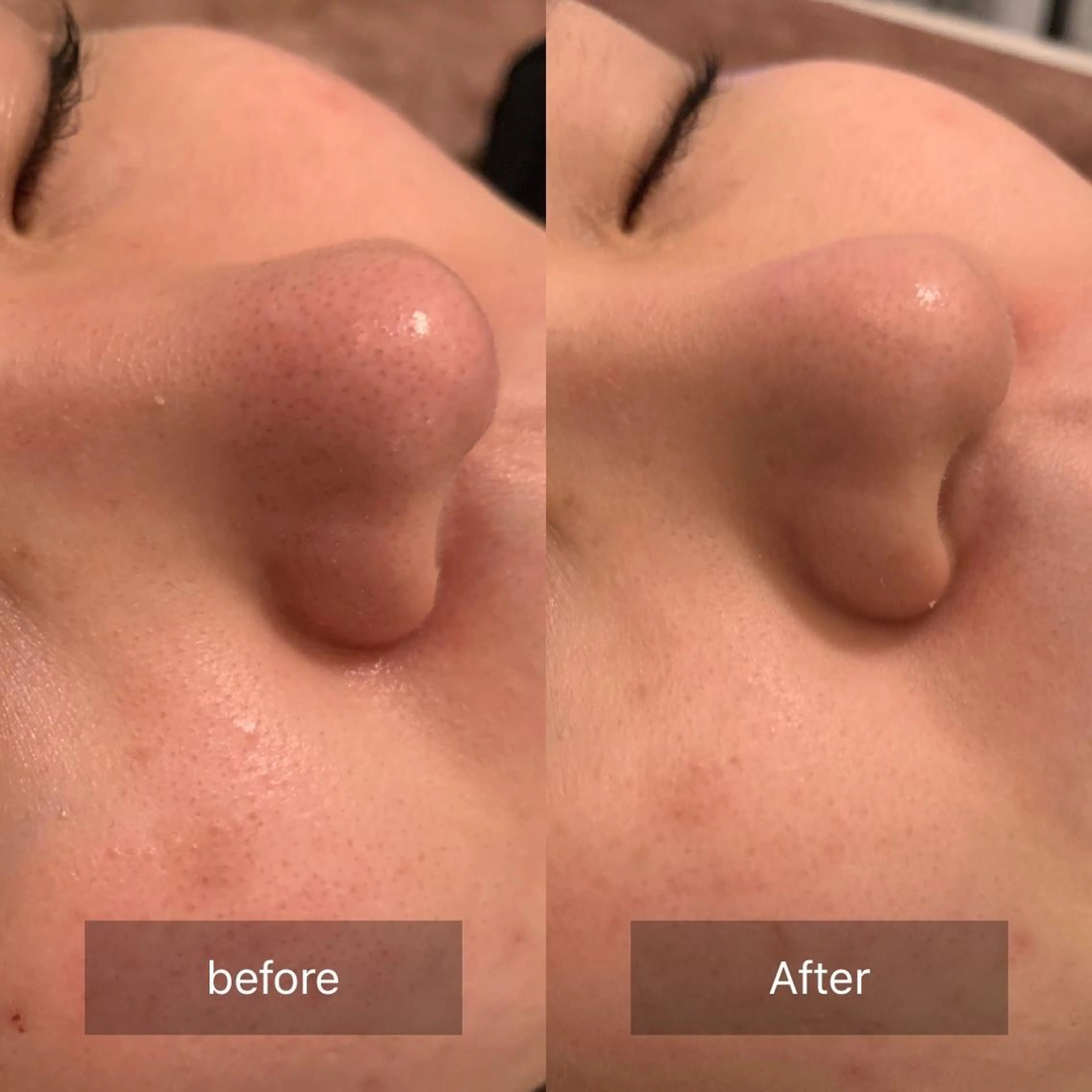 渋谷ベルゼ🌷木下 毛穴/脱毛/フェムのその他イメージ